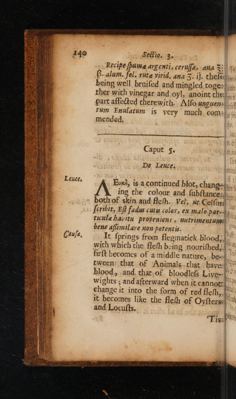 . Se ee ee wen nag Oo ee bog : ee Z ; y eek * a y - * Pat ate Leuce. Gaufa, Recipe pume argenti, ceruffe, ana S| % (.alum. fol. ruta virid, ana 3. iJ. the fede); being well bruifed and mingled LOSER! ji, ther with vinegar and oyl, anoint hed... part affected therewith. Alfo unguens \,.1 y] tum Endlatum is very much. com::, ‘, mended, Caput. 5. De Leuce: Evxi, is-a.continued blot, chang+)).. ing the colour and. fubftances,\:. both of skin. and fleth.. Vel; ue. Celfassl fcribit, Eft fadus cutis color, ex malo pared tuulahavitu proveniens , nutrimentunm\ bene afimilare non-potentis. e It {prings from flegmatick bloody.) t with which che fleth being nourithedy,) firft becomes of a middle nature, be--)_ | tween! that of Animals..chat havect “ blood, and. that,of bloodlefs Lives:| wights ; and afterward when it cannot: 1 change it into the form of red fleth, oy it becomes like the fleth of Ovfterss) *™ and Locufts. Tissh™
