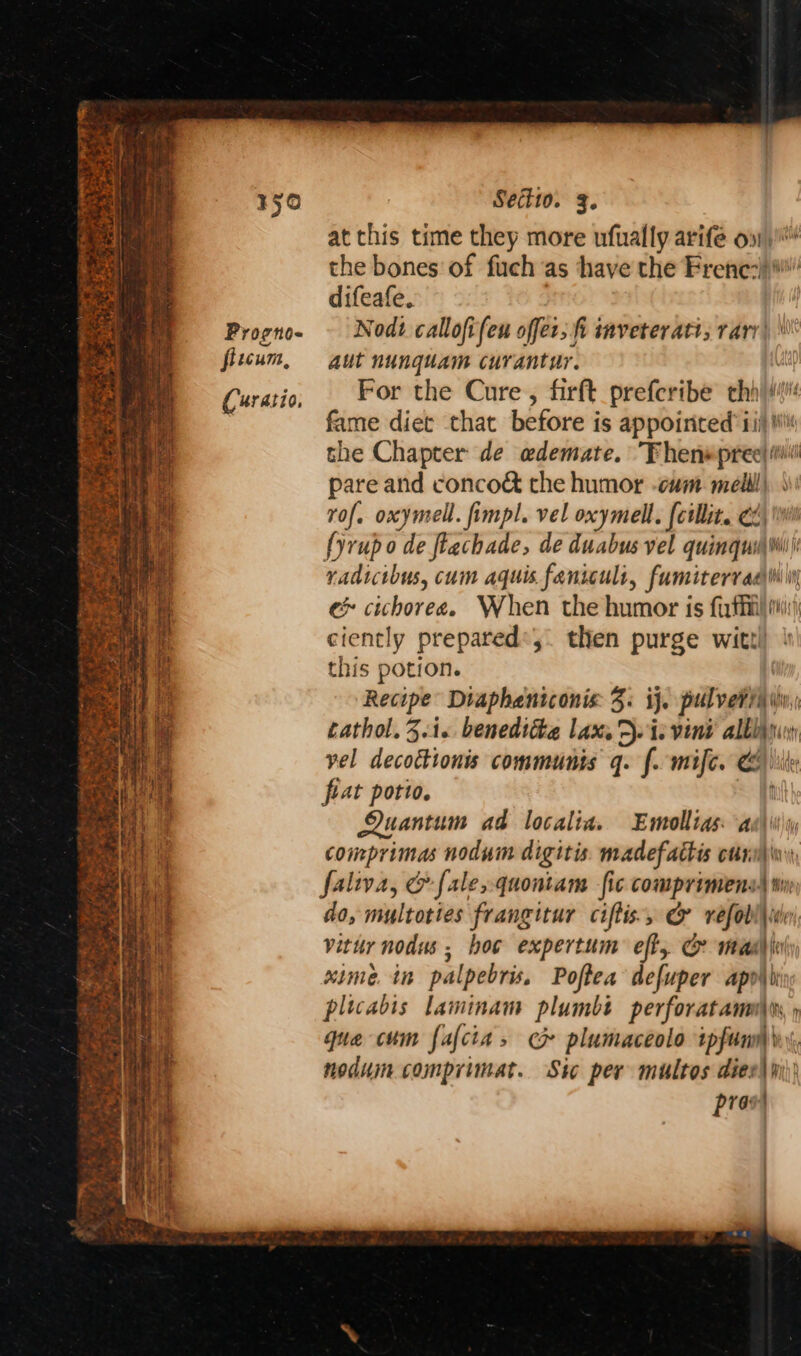 RAE TE PRR Potesate os Progno- fitcum, Curatio, Sectio. ¢. at this time they more nfually arife ov)! the bones of fuch as have the Frene:) difeafe, | Nod? callofifen offer; fi snveteratt, rary) \\' aut nunquam curantur. : For the Cure , firft_preferibe thi! fame diet that before is appointed ii) Wiis the Chapter de edemate. Fhen»pree! i pare and conco&amp; the humor -cum melll\ | rof. oxymell. fimpl. vel oxymell. (cillit. C4) \wi fyrupo de flachade, de duabus vel quinqui\wiii radictbus, cum aquis.faniculi, fumiterradiniliy e cichorea. When the humor is firthil iii:) ciently prepareds,. then purge wittl this potion. Recipe Diaphentconis: 3. ij. pulvevih wi tathol. 3.i« beneditte lax. Doi: vini albany vel decoctionis communis q. f. mife. Coil flat potio. ft Quantum ad localia. Enmollias: aa i\iy comprimas nodum digitis. madefachis ctini)in\ faliva, @ fale, quontam fic comprimens§ tin do, multoties frangitur ciftis., &amp; refobl\ine vitur nodus ; hoc expertum eft, Gr main xime. in palpebris. Poffea defuper apvib plicabis laminam plumbt perforatanm\ys que cum fafcia, ce plumaceolo ipfumi nodum comprimat. Sic per multos dies) prow)