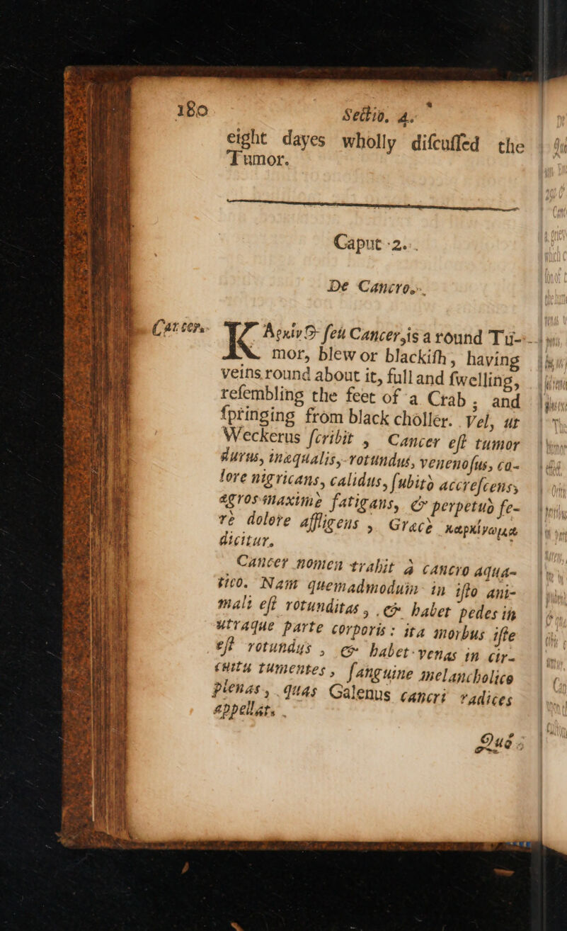 et ee ate) Z F he wey 4 _ ik ; . — sheep AF ot oo a serene En paemank ee 2 ane a - ~ = = Ps Settio. A. Teumor. Caput:-2.:. Dé Cancro.». mor, blew or blackith, hayin veins. round about it, fulland {welling, refembling the feet of -a Crab ; and {ptinging from black choller. Vel, ut Weckerus fcribit » Cancer eft tumor aurus, inequalis,-rotundus, venenofus, co- lore nigricans, calidus, (ubitd accrefcenss egrosmaxime fatigans, ¢r perpetuo fe- re dolore affligens , Gree? HeepKl verre dicitur. Cancer nomen trabit 4 cancro AquUA- $100. Nam quemadmoduin: in ifto ani- malt eft rotunditas, ec haber pedes it urvaque parte corporis: ita morbus ifte eff rotundys , e@ habet-venas in Ctr. cuits tumentes, fanguine melancholico plenas, quas Galenus cancri radices appellats . Ore