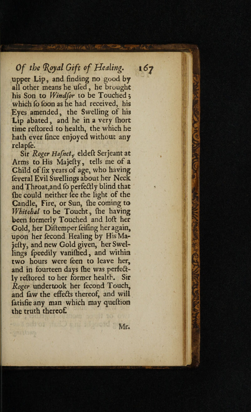 upper Lip , and finding no good by all other means he ufed, he brought his Son to Windfor to be Touched ; which fo foon as he had received, his Eyes amended, the Swelling of his Lip abated, and he in a very (hort time reftored to health, the which he hath ever (jnce enjoyed without any relapfe. r Sir Roger Hafnet,. eldeft Serjeant at Arms to His Majefty, tells me of a Child of fix years of age, who having feveral Evil Swellings about her Neck and Throat,and fo perfettly blind that (he could neither fee the light of the Candle, Fire, or Sun, (he coming to Whitebd to be Toucht, (he having been formerly Touched and loft her Cold, her Diftemper feifing her again, upon her fecond Healing by His Ma¬ jefty, and new Gold given, her Swel¬ lings fpeedily vaniftied, and within two hours were feen to leave her, and in fourteen days (he was perfect¬ ly reftored to her former health* Sir Roger undertook her fecond Touch, and few the effe&s thereof, and will fetisfie any man which may queftion the truth thereof! Mr*