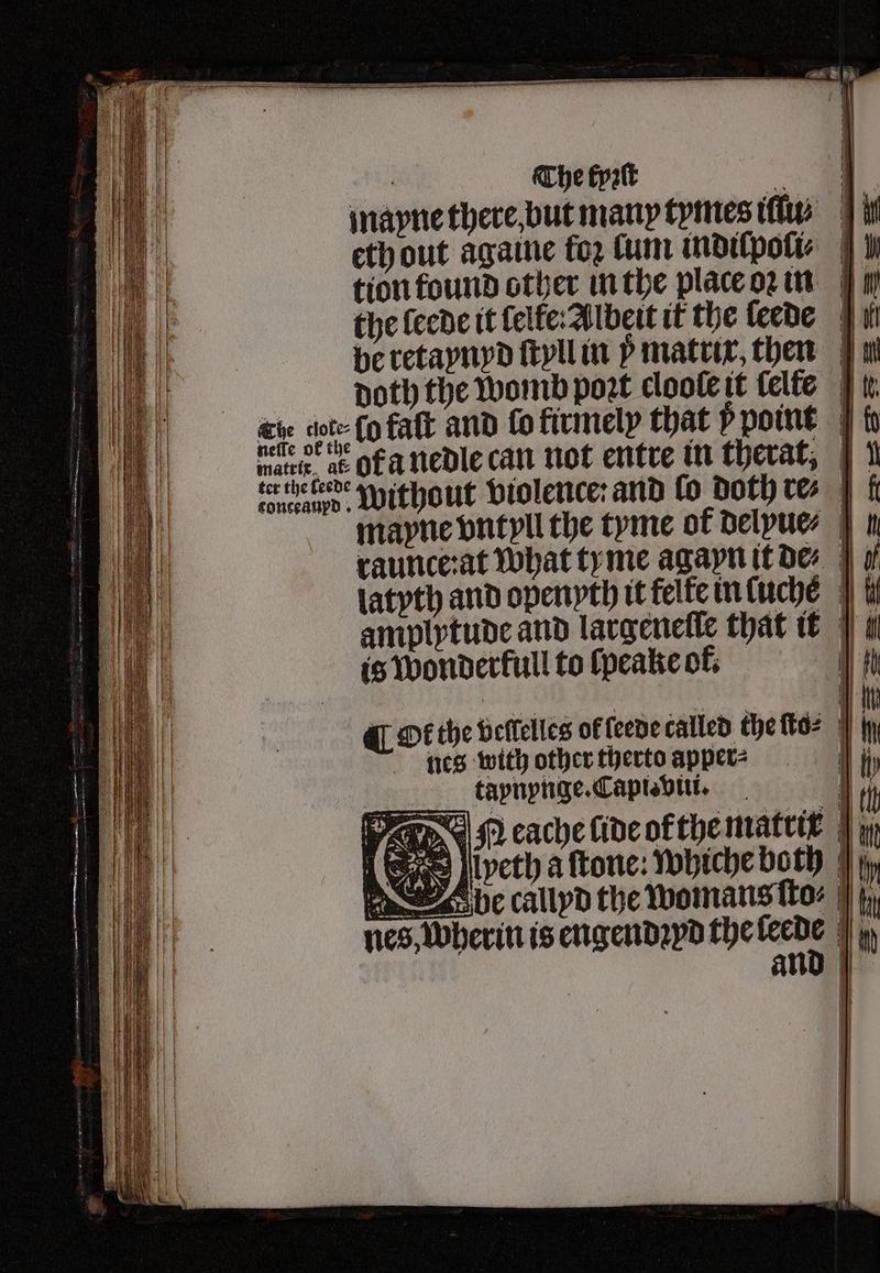 ! The tpꝛſt = q | mayne there but many tymes iſſu⸗ it eth out againe for lum indilpoli⸗ ih tion found other in the place oꝛ in 7 i the (cede it lelke; Albert it the leede if be retaynyd ſtyll in matrix, then il doth the womb poꝛt cloole it ſelſe tr. aie cote lo falt and lo firmely that ÿ point n marc ar oa nedle can not entre in therat, 1 due Without violence: and fo Doth res ff mayne vntyll the tyme of delyue⸗ n raunce:at what ty me agayn it de⸗ d latyth and openyth it felte in luche i amplytude and largeneſle that it is wonderftull to ſpeake ok. 100 ( Or the vellelles ok leede called the ſto⸗ 7 jy nes with other therto apper? st hy taynynge. Capi: viii. | 0 1 N cache lide orthe matrir | yi veth a ſtone: whiche both be callyd the womans ſto⸗