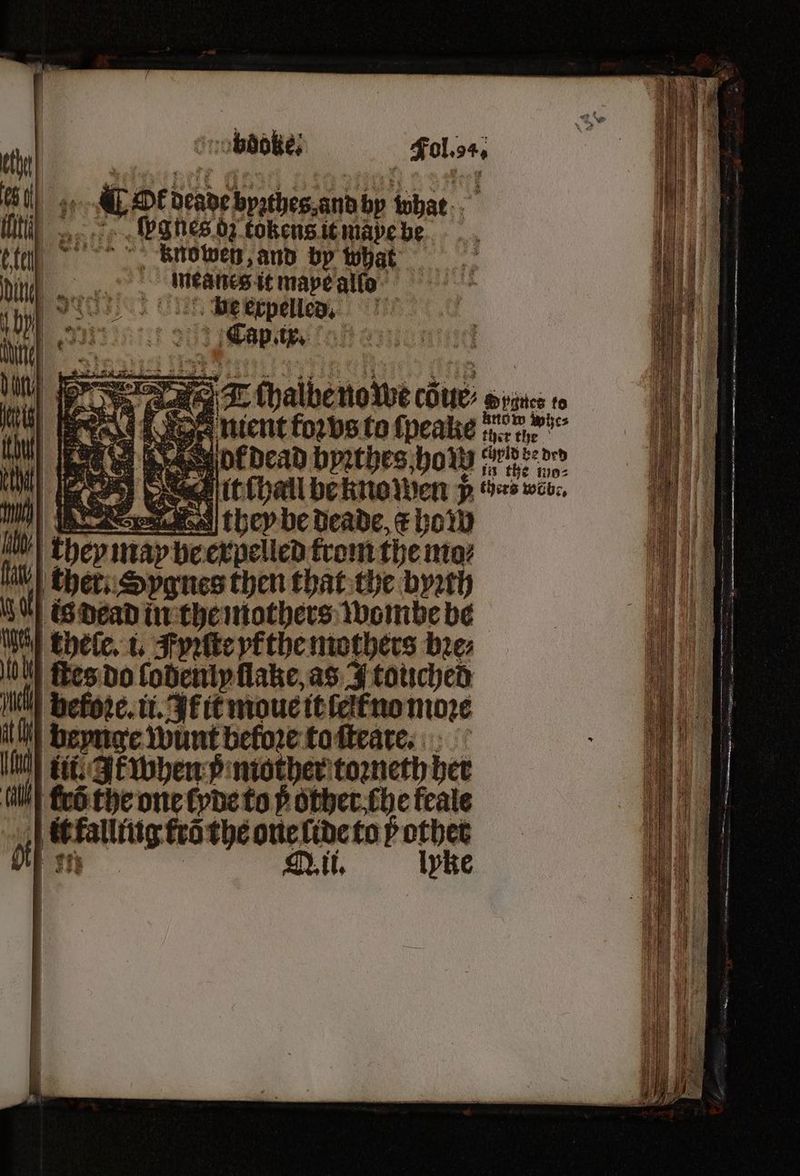 Snobbdoke, Fol. 4. ot deade byzthes and by that. ſpgnes oz tokens it maße be tte, ~ knowen, and by what 10 “i meanes it mape alſſo i n nt erpene ss, Capi. T ſhalbe nowe cöue Senne to re g nient kor vs to ſpeake tree” e otcdead bpꝛthes hom nette ne tt chau beknowen 5 es web. — 1 N 0 uy at} ts 0 kes do lodenly flake as A touched INN before. ti. Akit moue it le no moze beynge Wunt before to ſteare. fit: Ak when p mother toꝛneth her iil fe6 the one tyde to p other che feale it falling fro the one lide to ÿ othet