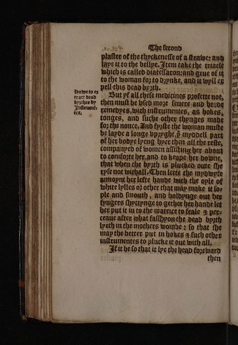 £0,803 The ſecond | platter of the thyckeneſſe of aftvatycsand |), lave it to the bellpe.Jtemtakethe triacle which is called diateſſaron:and geue of te | to the woman koz to dꝛynke, and it wyll ey to er Vellthis dead byath. - We fact dead But PE all thele medicines pꝛolette not, aa vemenpes, with inficumentes, as hokes, forthe nonce, And kyꝛſte the woman mute | be layde a longe vpꝛyght, ß myddell part to conifozte her and to keape her downe, role not withall⸗ Chen Lette the mydwyke annoynt her lelte hande with the ople of |; white lylles oꝛ other that may make it ſo⸗ i, ple and finouth , and holdynge out hen fyngers ſhyttynge to gether hen hande let her put it in to the matrite to keale & pers | ceaue atter what kaſſhyon the dead byꝛth lyeth in the mothers wombe: fo that ſhe may the better put in hokes a ſuch other inſtrumentes to plucke it out with all. Ik it be fo that it lye the head e 7 then