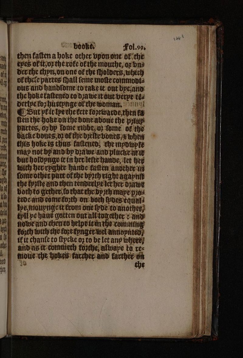 then fatten a hoke other vpon one ok the der the chyn on one of the ſholders, which bol thele partes ſhall ſeme moſte comnodt⸗ dus and handlome to take it out bye and |} But pit ipe che tete toꝛewarde then ka ken the hoke on the bone abone the peux backe bones dz ok che bꝛeſte vones v when this hole is thus kaſtened, che mpowyke map not bp and by dꝛawe and plucke w with her ryghte hande kaſten another in tede and come toꝛth on both lydes equal be, moupnge it rom one ſyde to another; chli ye haus gotten out all together: and koꝛth with the koze kynget wel annoynted lidl it chante to ſtycke oz to be let any where and as it commieth forthe; alwape ta re⸗ the hobes farther and farther g