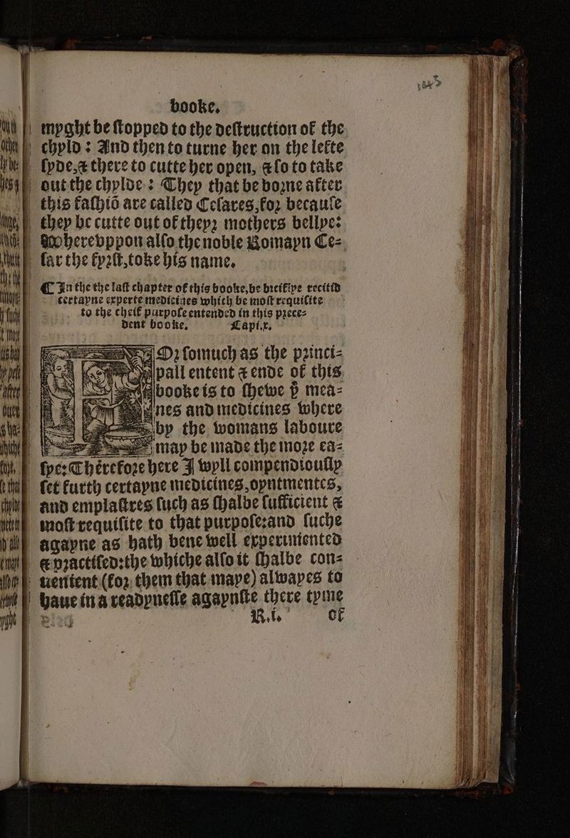N booke. myght be ſtopped to the deſtruction of the . ſyde, & there to cutte her open, efoto take out the chylde: They that be bozne after this kaſhiõ are called Ceſares, oz becauſe certapne experte medicines which be moſt requilite to the cheik purpofe entended in this pꝛece⸗ dent booke, Capi. x. 74 > J eo by Se | 2 ier =J a | TPA 1 S = — | foe: The et kurth certayne medicines opntinentces, and emplattres ſuch as ſhalbe luflicient & | moftrequifite to that purpoſe:and luche agapne as bath bene well experimented & pꝛactiſed:the whiche alſo it (halbe con⸗ uentent (koz them that mape) alwapes to baue in a readyneſſe agent. there tyme