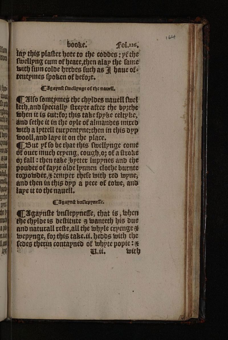 | bbooke⸗ Fol. 126, 0 lay this platter hote to the codes: ye the | fvellpng cum of heate, then alap the lame with {inn colde herbes ſuch as haue ol⸗ tkentpmes ſpoken of bekoze. Cagapnſt Twellpnge of the nauell, | © Allo fomepmes the chyldes nauell fuel leth, and ſpectallp ſtreyte after the byꝛthe when it is cut:kfoꝛ this take ſpyke celtyke, nd ſethe it in the oyle ol almandes mixed vith a lyttell turpentyne:then in this d yp wooll, and lape it on the place. | ¶ But pk ſo be that this ſwellynge come n of ouer much crpeng, cough, oz of a ſtroke Wh 02 fall: then take bytter lupynes and the pouder of kayze olde lynnen clothe burnte topowder, & temper thele with red wyne; and then in this dyp a pece ef towe, and lape it to the nauell. Agape bntleppneſſe. | CAgapnſte vnllepynelſe, that is, when the chylde is deſtitute c wanteth his due and naturall refte all the whyle cryenge a weppynge, koꝛ this take. ii. hedds with the I ſedes therin contapned ol whyte popie: