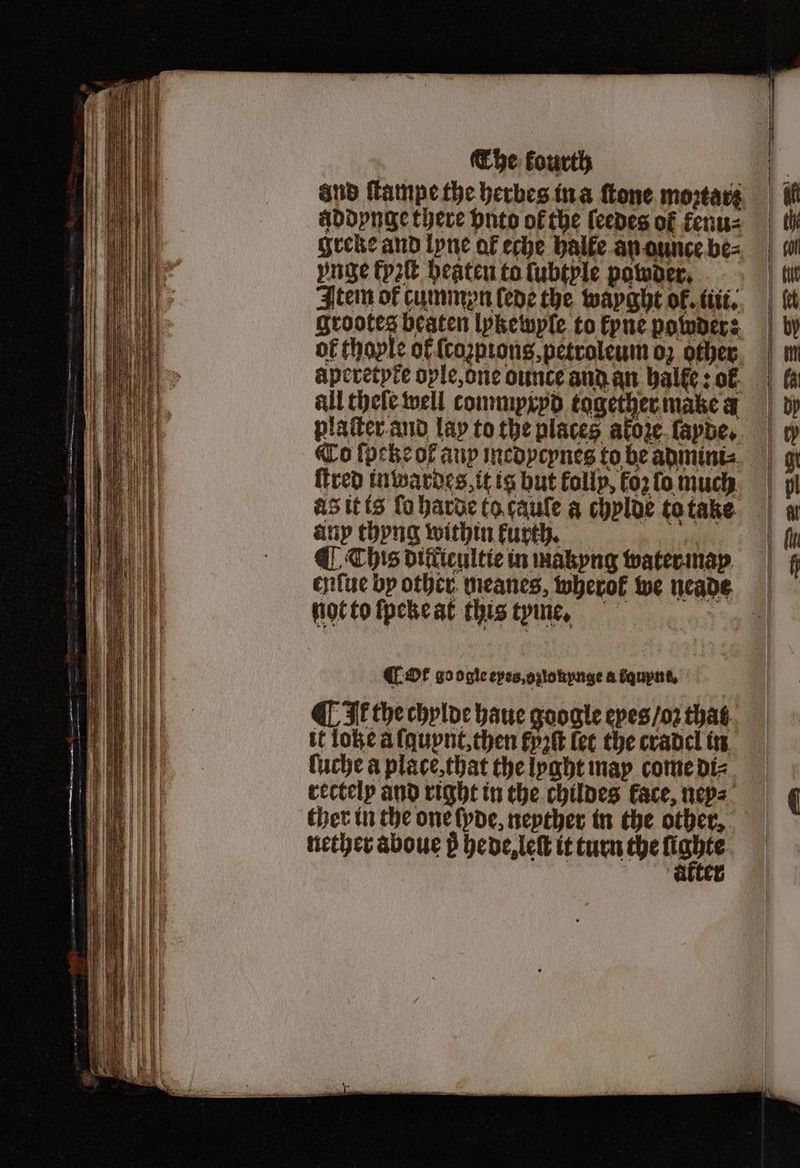 addynge there ynto of the ſeedes ol tenu⸗ greke and lyne al eche halte an aunce be⸗ unge kyzſt beaten to ſubtyle powder. Item of cummpn lede the wayght of. fit, grootes beaten lykewyſe to kyne powder: of thoyle of ſcoꝛpions, petroleum oʒ other all thele well commpxyd together make a plaſter and lay to the places akoze ſayde. qo ſpebe of aup medycynes to be admini⸗ ſtred inwardes it ig but follp, koz lo much as it ts ſo harde ta tauſe a chylde to take any thyng within kurth. ¶ This diflicultic in makyng water may not to ſpeke at this tyine, EOL go ogie eyes, oꝛlonynge a fquynt, ¶ Ik the chylde haue google eyes / oz that it Lobe a lauynt, then Fyre let the cradel in Cuche a place, that the lyght may come di⸗ rectely and right in the childes Face, ney⸗ ther in the one ſyde, neyther in the other. nether aboue p hede, leſt it turn the 1 arter