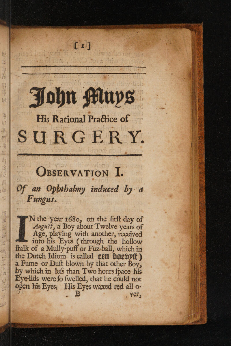 5 Ur ohn Muys His Rational Practice of YSU RG ERY. Of an Opbthalmy induced by. a4 Fungus. “a N the year 1680, on the firft day of 4 Auguit, a Boy about Twelve years of = Age, playing with another, received eee into his Eyes (through the hollow ftalk of a Mully-puff or Fuz-ball, which in the Dutch Idiom is called gett hoenptt ) a Fume or Duit blown by that other Boy, by which in lefs than Two hours fpace his Eyelids were fo fwelled, that he could not open his Eyes, His Eyes waxed red all o- ? Ss ae _ ver,