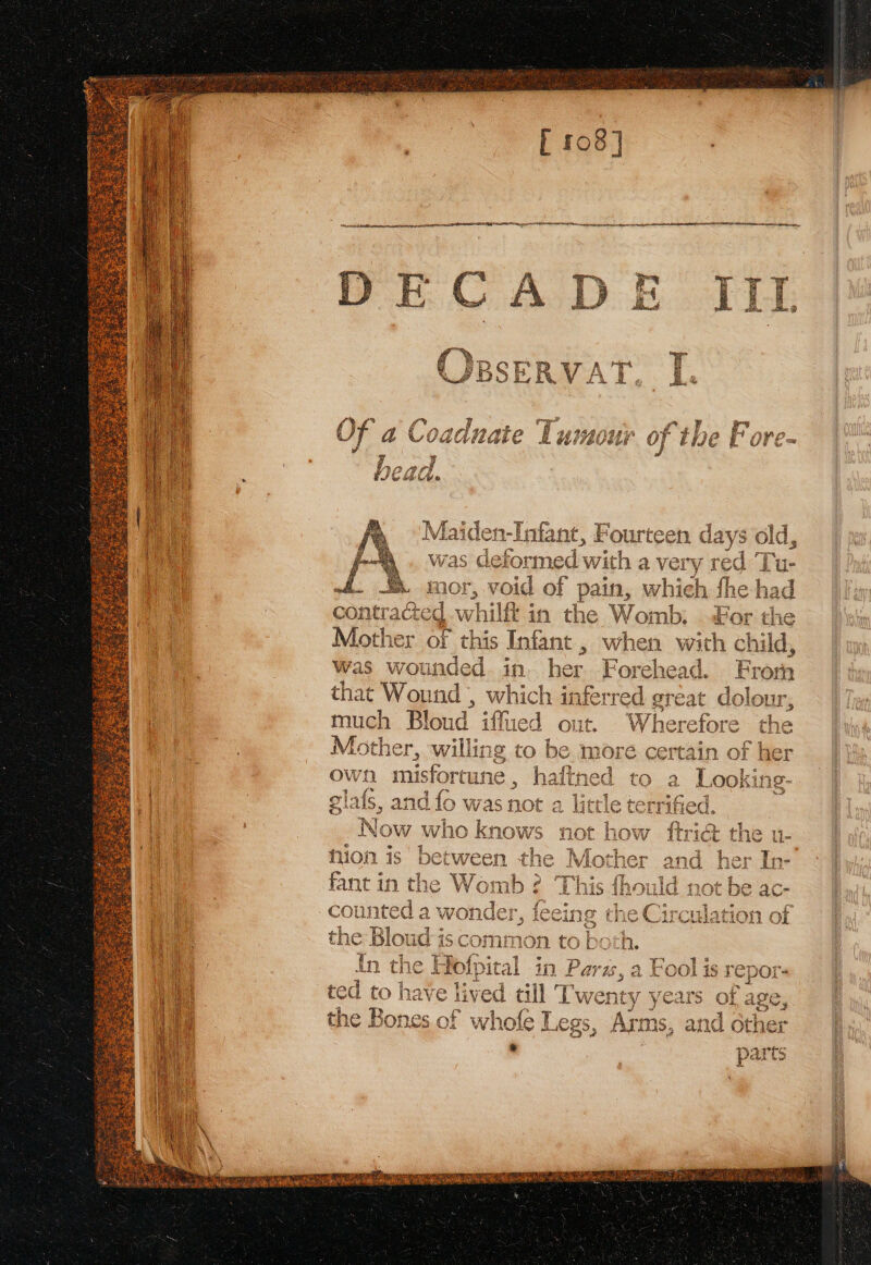 [ 108] GA a co at A ITC IE SEE Tse RRS SS See Mai len-lnfa nt, Fourteen days old, A. was de deformed with a ver y red Tu- ©. mor, void of pais which fhe had contracted whilft in the Womb: For the Mother of this Infant , he i wich child Was wounded. in her. kore ead. Frorn that Wound , ae ch ink ctype 91 he at lolouz much Bl oud i ied out. Mother, ice g to own misfortune . | glafs, and fo was Now who k now hion is’ between th fan it in the Womb counted a oe fe