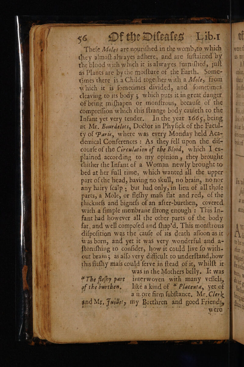 | 56 bee | Thele Afoles are nouril ifhed.in the v vomb,to which they almoft alwayes ad dhere, and are fuftained by the blood with whieh it is alway yes furnifhed, jut as Plants are by the moiftare of the Earth. Some- | times there 1s a Child together with a AZole, from which it is fometimes divided, and fometimes cleaving co its body 5 which puts it in great danger Gtr mifhapen or monf{tr¢ OUSy becaule of the compreifion which this {trange body cauleth co the Infant yet very tender. In ‘the } year 1665, being at Mr. Bourdelots, Doctor in Phyfick of the Facul- ty of Paris, where was eyery Monday held Aca- demical Conferences : As they fell upon the. dif- courfe of the Cirewlation of the Blood, which 1.ex- plained according to my opinion, chey broughe bither the Infant of a Woman ney wly brought to bed at her full time, which wanted all the upper part of the head, having no skull, no brain, no Agk any hairy fcalp 5 buc had only, in lieu of all tho parts, a Mole, or flefhy mafs flat and red, of ae i thicknefs and bignefs of an after-burthen, Comoed i wich a fimple wenibrane {trong enough : This In- Fant had however all the other parts of the body ee far, and well compofed and fhap’d. This monttrous , difpofition was the caufe of its death afloon as it : was born, and yet it was very wonderful and a- a ftonifhing to confider, how it could live fo with- fh out brain; as alfo very difficule to underftand how 4 this ficfhy mafs could ferve in ftead of it, whilft it Brn was in the Mothers belly. It was ie *The flehy part interwoven with many vefiels, ba, of the burthen, | like akind of * Placemta, yet of a ore firm fubftance, Mr.Clerk and Mr, Jude, my Brethren and good Friends, were lion Sa. aD aes re = | ya Se oe pe