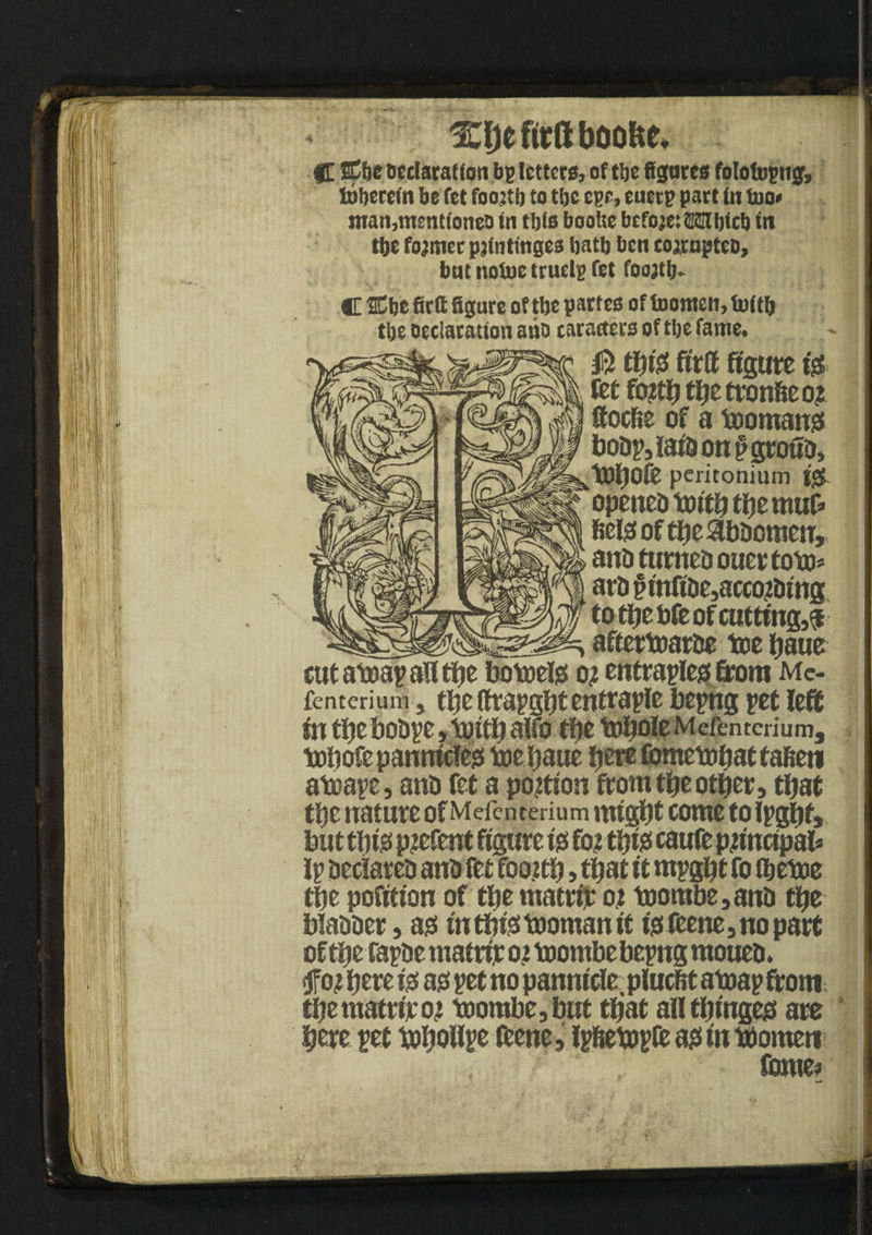 1Uje ftrft boofce, C SC6e bedaratfon bg letters, of tbe figures folotoptig, tobercin be fet foojtb to tbc ege, euecp part fit too* man,menttoneb in this booftc bcfojcOTlfjicb in t&e former pstatinges fiatb ben coirupteb, bat notoe truelg fet foojtfi. C ®be firtt figure of tbe partes of toomen, toitfi tbe Declaration ano taracters of tbe fame. 0 tin's! fit ft figure iss tbc tronfee o? 1 ^ **  *■ flocfie of a toomans! boDp,iatDon}>grouD, tDbOfe peritonium i& opened toitb tbe muf* feels! of tbe abdomen, and turned ouertoto* art) § infide,acco?ding to tbe bfe of cutting# _ aftertoarde toe baue cut atoap all tbe botoeis! o? entraples! from Mc- fenterium, tbe ftrapgbt entraplc bepng pet left in tbebodpe, toitb alfo tbe toboleMcfentcrium, tobofepanmcleo toe baue feerefometobattafeeti atoape, anti fet a portion from tbe other, that tbe nature of Mefcnterium might come to Ipgbt, but this! piefent figure to fo? this! caufe principal* Ip Declaret) anD fet foottb, that it mpgbt fo fbetoe the petition of the matrtr ot toombe,anD the blaDDer, as! in this! tooman it tssfeene,nopart of the fapDe matt# 02 toombebepng raoued. hereto ao pet no panmcle, plucfet atoap from tbematriroi toombe, but that all tbingeo are here pet toboHpe feene, Ipfeetopft as! in tdomen fame?