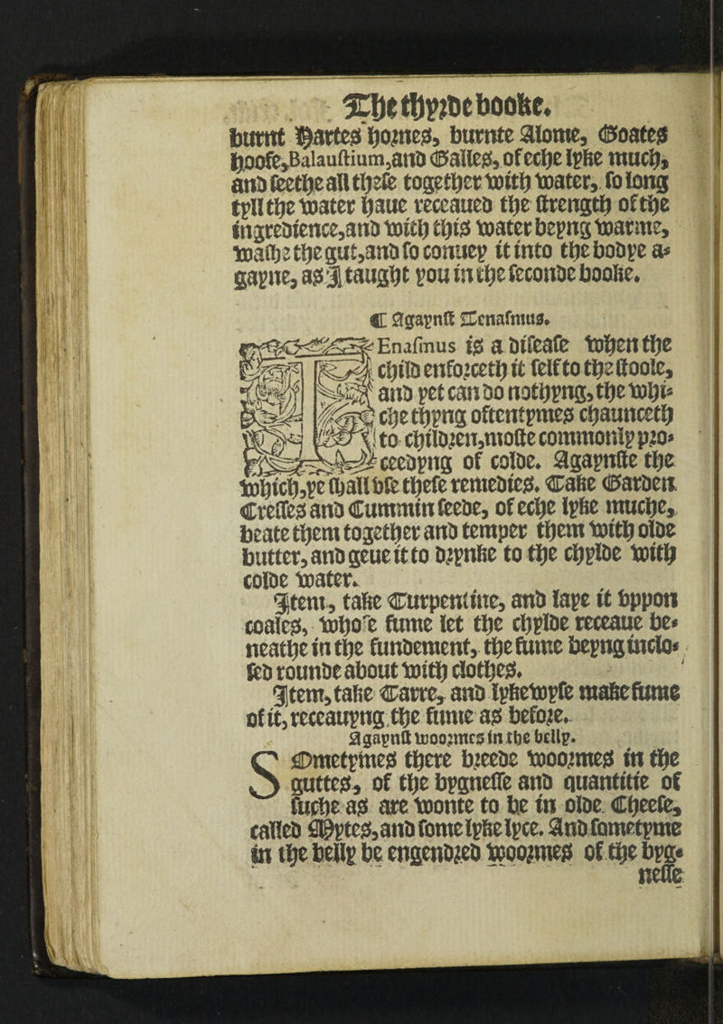 burnt $artes)b<we0, burnte aiorne, OoatejS b.oof0»Baiauftium,ano tallest, ofecbe Ipfie much, anb teethe ail thete together toitij boater, fo long tpll the boater tiaue receaueb the flrength ofthe «ngrebtence,anbbotth eijtsf boater bepng boar me, boafl)2tbegut,3nbfoconuep it into tfiebobpea* gapne, as)! taught pou in the teconbc boofie. C StprnK Ccnafmua. bo^cCpeajalfbfe tbefe remebtes).* Cafie €)arben CrelTestanb Cummin feebe, of eche Ipfie muefie, beate them together anb temper them bottp olbe butter, anb geue it to bjpnfie to tije cpplbe bottp colbe boater. Item, tafie curpentwe, anb tape it bppoti coales), bopore fume let the cpplbe receaue be* neatpe in tpe funbement, tpe fume bepnguiclo* teb rounbe about boitp clottjesf. 95tem, tafie Carre, anb tpfiebopfe mafieftmie of tt,reccaupng tpe fume as) before. SfiDmetpmes) there bjeebe booojmes) fn the gutter, of the bpgnefie anb quantftfe of fuche as) are boonte to be in olbe Cpeefe, calleb #ptes),anbfomeipfielpce. anbfometpme neffe