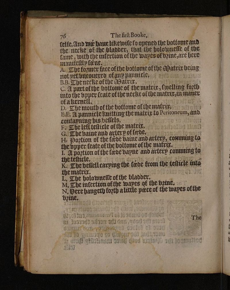 felfe, dnd wer haneltkewite fo opened the bottome and wranttelilp Tene. oe } Bb. A. She former face ofthe bottome of the Matrix being not petbricoucred ofanppannieg,. : : BB.Cheneckeotibe Matrix, 9) ery C. Apart ofthe hottomte of the matvix, twellny forth into the boper feate ofthe necke ot the matriv,m mance of akerneti, : ie D. The mouth of tbe bottome ofthematty, os BE. Gi panntele kntiting the matvty to Periconeum, and contapning bis deilels, Fy She lett telttcle ofthe matrty, G.l be baine and artery of twoe, | ate H: Dovtton of the fede baine andarterp, conummig ta fhebpper teate ofthe bottomestthe matty, 7 I. Aportion ofthe fede hapne and arterp comming to the tetticie, dun Givin Het atgOewy Ke Che dellelicarping the {ene from the telttcle mito the matriy, : neice L, Lhe bolowneile ofthe bladder, M, Che tuferttion ofthe apes ot the Dame, D8 hanceth fozth alittie pace of the wapes of tbe 2tne, :