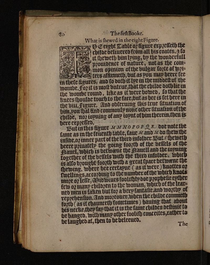 Zo ” The firftBooke. __ Whatis fhewed in the eight Figure. fayZs | chilocdelinered from all bis coates, ¢fo As (AA. tt hetoeth bimiping, bp the wondevtull | [Pe neoutdence of nature, notas the cont- eR? MON opinion ofthe bulgar fozte of w2t- a: GS ti ere -? att miide,oz inner part ofthe thd infoloer. But s thewetp Heerepeiuately the going foozth of the hellels of the Panel, which ts betwene the spall and the topning together of the petlels with the Thiva mfolder:, ihtcD 1s allo beougbt foozth with a great (pace befwmerne the thewinr, where bee certapne (as itwere ) Kuottes 02 fwellings according to thenumber of tbe which Knots mto2e N2 ele, Pidwiues foolthip doc peophere er fer o2 many chilozento the woman, tobich of the lear=