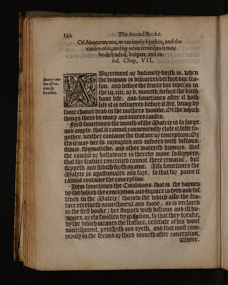 fes of vn— timely byrthes. , OfAborcements, onvntimely, byrthes, and the > eanlesofic,and:bywhatremediesitmay, ) Svigierbedefended; holpen; and ¢a-: << fed. Chap, VII, . ‘ smo WSa2cementiog Dutimelpbyeth is, when Wray. Lhe momaw is deliucredhectozeduelea- SSa\Cu baue life, and.fometines atter i bath. Alife itis pelinered betozett fit, bey bp gether; netther-containe the featuveoe conc eptton:D2 monty in the fecond oz third monet) atter cone a