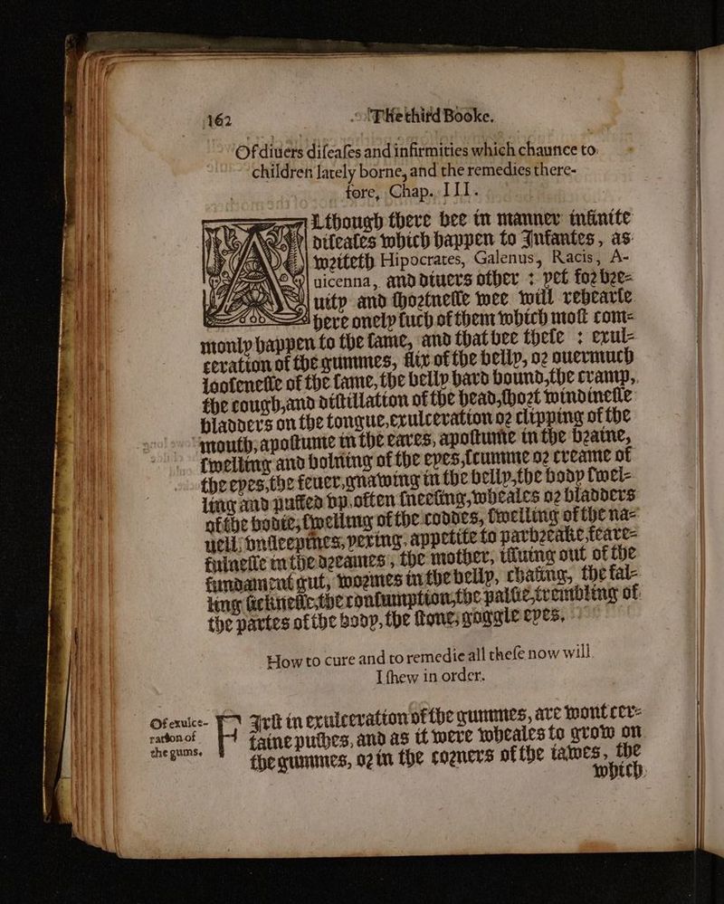 } | + 162 .'PRe third Booke. Of divers difeafes and infirmities which chaunee to. children lately borne, and the remedies there- _ fore, Chap. III. Lthough there bee tn manner infinite pifeales which happen to Anfantes, as A swetteth. Hipocrates, Galenus, Racis, A- rae | uicenna, anddiuers other > pet fozbee- PEFR uitp and thoztnetle wee will rebearte Ipere onelptuch ofthem which mot com monty happen fo the fame, and that bee thefe : exvul- cerationof thegunmnes, flix of tbe belly, o2 ouermucd {sofenetie of the fame, ihe belly bavd bound,the cramp, fhe cough,and dittillatton of the head,thozt mind inefle blanaers onthe tongue, erulcervation oz clipping of the mouth; apattume tn the eaves, apottunite inthe beame, {welling and bolning of the epes,tcumine o2 creame of theepes,the feucr. gnawing tt the belip.toe body fwel- ling aid pufiea bp.often fneeting, wheales o2 bladders ntthe bonie; finclimg of fhe. coodes, felling of fhe na- uci: Dnieepmnes, pering. appetite fo pavbeeatie feare- fuinciie mipeazcames', the mother, tung out of the fundament gut, woes inthe belly, chatting, the tal- Ling Gickinietiestberontamption;the palte,tv embling of: the partes ofthe body, the Rone; yogale eyes, How to cure and to remedie all thefe now will I thew in order. ratéon of the gums, iaine putbes, and as tt were wobeales to grow on thegununes, o2in The cogners of the panne