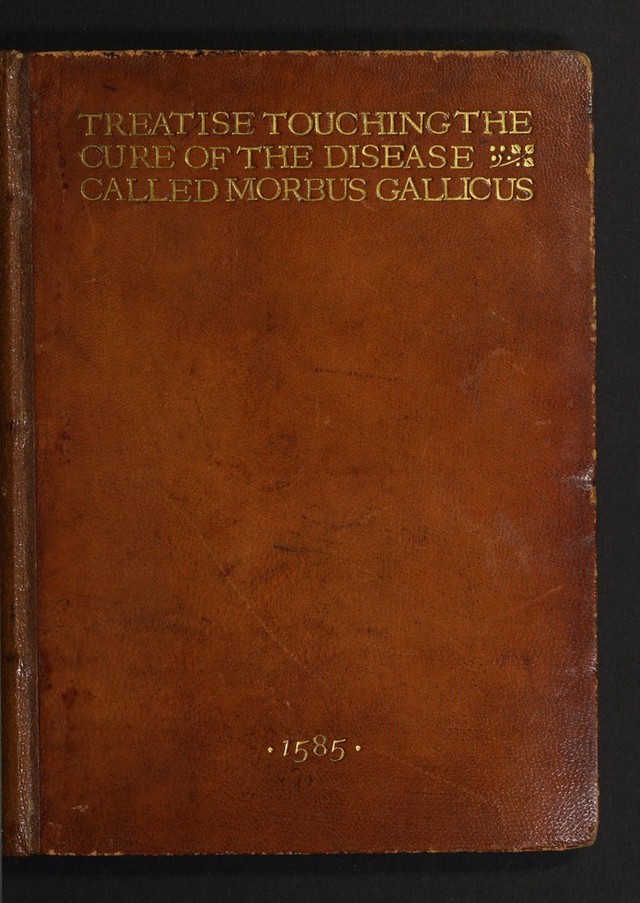 No text description is available for this image