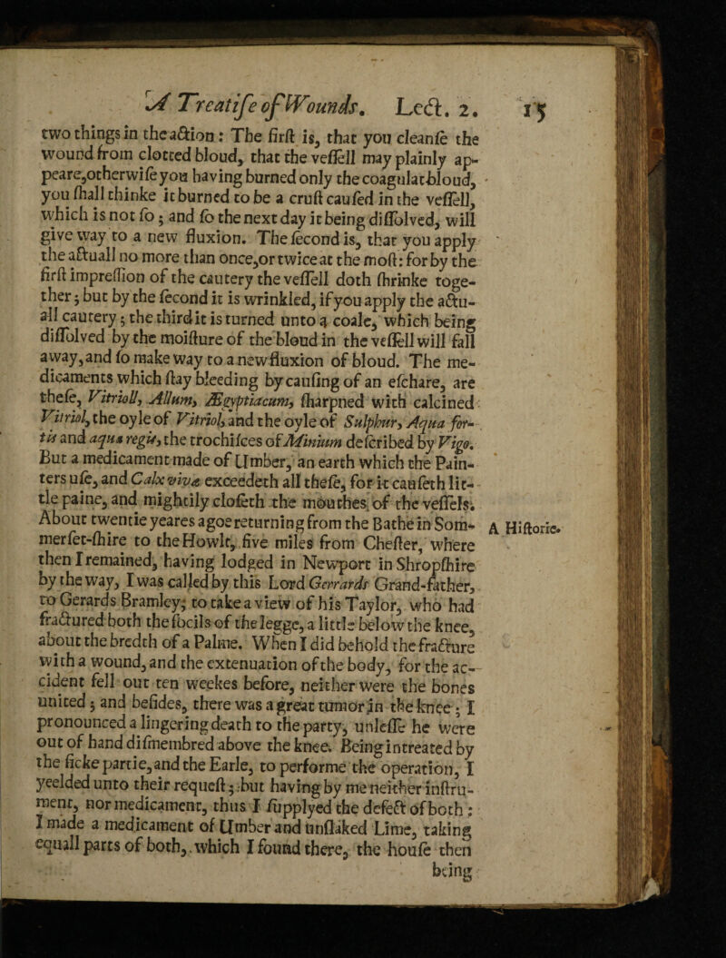 two things in thea&ion: The firft is, that you cleanfe the wound from clotted bloud, that the veflell may plainly ap¬ pears,otherwife you having burned only thecoagulat-bloud, ' you /hall thinke it burned to be a cruft caufed in the veflell, which is not fo • and fb the next day it being diflblved, will give way to a new fluxion. Thefecondis, that you apply ; the aftuall no more than once,or twice at the moft: for by the flrft impreHIon of the cautery the veflell doth ftirinke toge¬ ther ’y but by the fecond it is wrinkled, if you apply the a&u- all cautery; the third it is turned unto a coale, which being diflfolved by the moifture of the'blend in the veflell will fall away, and fo make way to a new fluxion of bloud. The me¬ dicaments which ftay bleeding bycaufing of an efehare, are thefe. Vitrioliy Allunty JEpptiacum, fharpned with calcined; Vitriol, theoyleof ri/ri^and the oyleof Sulphury Aqua for* , its and aqua regUy the trochifces of.Minium deferibed by Vigo. But a medicament made of Limber, an earth which the Pain¬ ters ufe, and Calx viva exceedeth all thefe, for it caufeth lit¬ tle paine, and mightily clofeth the mouthes. of the veffels; About twentieyearesagoereturning from the Bathe in Som* a Hiftoric* merfet-fhire to the Howlt, five miles from Chefter, where then I remained, having lodged in Newport inShropfhire by the way, I was called by this Lord Gerrards Grand-father* to Gerards Bramley- to take a view of his Taylor, who had fradtured both thefocils of thelegge, a little below the knee, aoout the bredth of a Palme. When I did behold the fradture with a wound, and the extenuation of the body, for the ac¬ cident fell out ten weekes before, neither were the bones united $ and befides, there was a great turn or jn the knee 5 I pronounced a lingering death to the party, unlefTe he we’re out of hand difinembred above the knee. Beingintreated by the ficke partie, and the Earle, to performs the operation, I yeelded unto their requeft $ ,-but having by me neither inftru- ment, nor medicament, thus I fupplyed the defeft of both : I made a medicament of Limber and tinflaked Lime, taking equal 1 parts of both, which I found there, the houfe then being