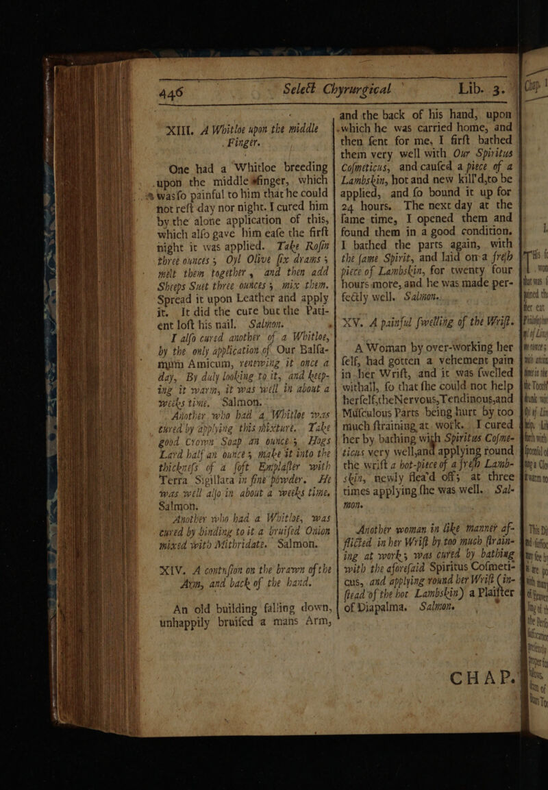 - SCORN tea EMOTE ay 5 a a XIU. A Whitloe upon the middle Finger. One had a Whitloe breeding upon. the middle #finger, which fot reft day nor night. I cured him by the alotie application of this, which alfo gave him eafe the firft might ic was applied. Take Rofin three ounces; Oyl Olive fix drams 5 melt them together, and then add Sheeps Suet three ounces mix then. Spread it upon Leather and apply it. It did the cure but the Pati- ent loft his nail. Salmon. by the only application of Our Balfa- mum Amicum, renewing it once a day, By duly looking to it; and kecp- ing it warm, it was well in about a weeks time, Salmon. Aiiother. who bad a, Whitloe ws cured by applying this mixture... Take good Crown. Soap an ounce.3 , Hogs Lard half an ounces make it into the thickness of a foft Emplafter with Terra Sigillaca in fine’ powder. He was well aljo'in about a weeks time, Salmon. Another who had a Whitlaet, was cured by binding to it a wruifed Onion mixed wit Mithridate. Salmon. XLV. A contnfion on the bravn of the Arm, and back of the hand. An old building falling down, unhappily broifed a mans Arm, then fent for me, I firft bathed them very well with Our Spiritus Cofmeticus, and caufed a piece of a applied, and fo bound it up for 24 hours. The next day at the fame time, I opened them and found them in a good condition. I bathed the parts again, with the (ame Spirit, and laid oma freh piece of Lambskin, for twenty four hours more, and. he was made per- feily well. Salion. XV. A painful fwelling of the Wrift. A Woman by over-working her felf, had gotten a vehement pain His fe won that was { pained th her eat Phlotey bo withall, fo that fhe could not help herfelf,cheNervous, fendinous,and Mufculous Parts being hurt by too much ftraining at. work, Icured her by bathing wigh Spiritus Cojme- ticus very well,and applying round che wrift a bot-piece of a fréh Lamb- skin, newly flea’d off; at three times applying fhe was. well. Sual- mone flicted in her Wrift by.tao much ftrain- ing at work; was cured by bathing with the aforefaid Spiritus Cofmeti- cus, and applying round ber Wrilt (in- forth wit of Diapalma. Salmon.