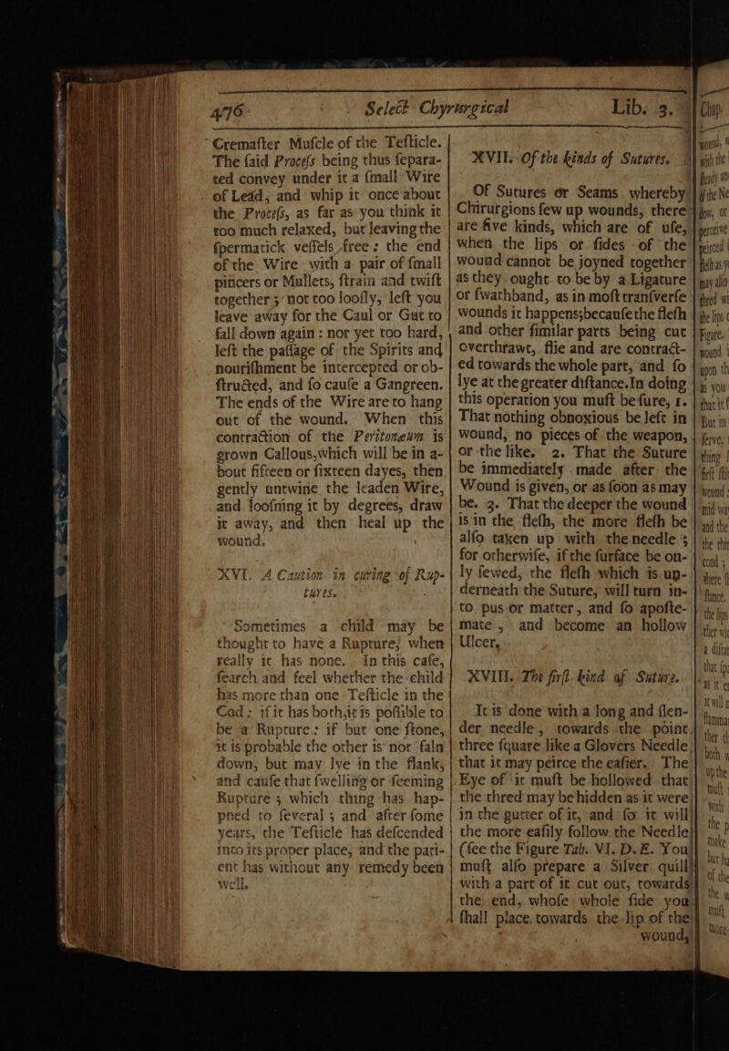 ~~ hoe a « =e eS Cremafter Mufcle of the Tefticle. The {aid Procefs being thus fepara- ted convey under ita {mall Wire of Ledd, and whip it once about the Proce(s, as far as you think it too much relaxed, but leaving the fpermatick veffels free: the end of the Wire with a pair of {mall piticers or Mullets, ftrain and twift together 3 not too loofly, left you leave away for the Caul or Gut to fall down again : nor yet too hard, left the paflage of the Spirits and nourifhment be intercepted or ob- ftructed, and fo caufe a Gangreen. The ends of the Wire are to hang out of the wound. When this contraG@ion of the Peritonenm is grown Callous, which will be in a- bout fifceen or fixteen dayes, then gently antwine the Jeaden Wire, and loofning it by degrees, draw it away, and then heal up the wound, | I, A Caution tn curing “oj Rup- LBYrES» metimes a child ‘may be thought to have a Rupture; when eally ic has none. . In this cafe, fearch and feel whether the child has more than one Tefticle in the Cod : if it has both,itis pofiible to be a’ Rupture. if but one ftone, | tt is probable the other 1s‘ not faln down, but may lye in the flank, and caufe that {welling or feeming Rupture 5 which thing has hap- | pned to feveral 5 and after fome | years, the Tefticle has defcended | into its proper place, and the pati- | ent has without any remedy been W LS ae Lib. 3. —_ MVIE. Of the kinds of Sutures. Of Sutures or Seams. whereby | Chirurgions few up wounds, there: are five kinds, which are of ufe, when the lips or fides of the wound cannot be joyned together as they ought to be by a Ligature or fwathband, as in mofttranfverfe wounds ic happens;becanfethe flefh and other fimilar parts being cut overthrawrt,. flie and are contra@- ed towards the whole part, and fo lye at the greater diftance.In doing this operation you muft be fure, 1. That nothing obnoxious be left in wound, no pieces of the weapon, or the like. 2. That the Suture be immediately .made after: the Wound is given, or as foon as may be. 3. That the deeper the wound is in the flefh,.the more flefh be alfo taken up with the needle 5 for otherwife, if the furface be on- ly fewed, the flefh which is up- derneath the Suture, will turn in- to pus or matter, and fo apofte- mate , and become an hollow Ulcer, XVII. The firft- kind af Suture. Ic is done with a long and flen- der needle, towards the poinc three {quare like a Glovers Needle, that it may peirce the eafier. The Eye of ‘ic muft be hollowed that the thred may be hidden as it were in the gutter of it, and fo it will] the more eafily follow the Needle} (fee the Figure Tab. VI. D.E. You) muft alfo prepare a Silver quill} with a part of it cut out, towards: the..end, whofe whole fide you fhall piace. towards the.lip of rhe flead' ap) ifthe Ne dow, Of perceive peirced | may allo thred W the lips Figure. wound | upon th thar it! But I ferve, | thing | firlt fh wound | mid wa and the the thr cond ; rhere f Rance, ho fir THe 110s