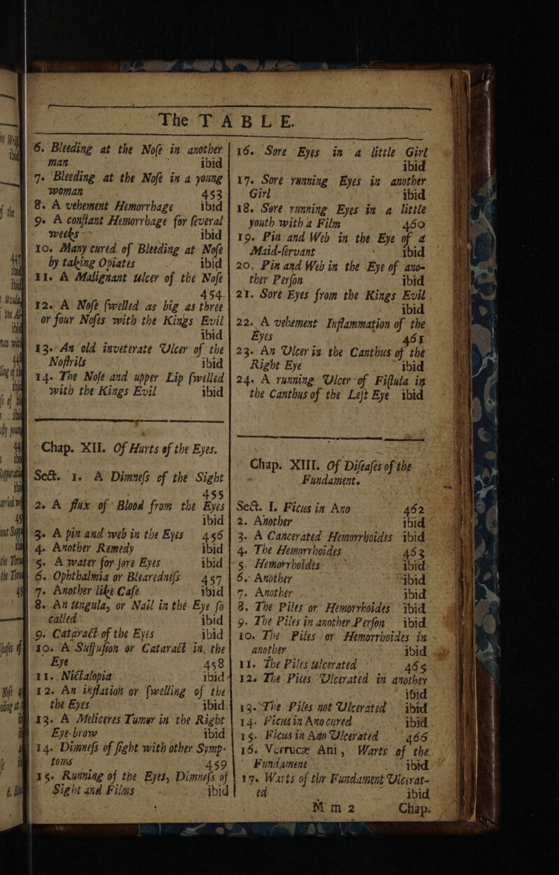 Ah ibid ibid Hla the A tidy na it a | ing i th ibid of Ibid fh ying ia | 1 pati Ibi oni i man ibid | 7- Bleeding at the Nofe ix a young woman . 453 8. A vehement Hemorrhage ibid 9- A conflant Hemorrhage for (everal weeks - ibid 10. Many cured of Bleeding at Nofe by taking Opiates ibid ii. A Malignant ulcer of the Nofe 454 12. A Nofe (welled as big as three or four Nofes with the Kings Evil ibid 13-° Ax old inveterate Ulcer of the Noftrits ibid 14- The Nofe and upper Lip (welled with the Kings Evil ibi (Ao teres Chap. XII. Of Hurts of the Eyes. Se&amp;. 1. A Dimes ef the Sight 455 2. A flux of Blood from the Eyes ibid A pin and web in the Eyes 4.56 Another Remedy ibid A water for jore Eyes ibid - Opbthalmia or Blearednefs 487 Another like Cafe ibid called 9. Cataract of the Eyes ibid ibid Eye 458 11.. Niétalopia ibid 12. An iéflation or (welling. of the the Eyes ibid Eyebrow ibid 14. Dimnefs of fight with other Symp- Loins 459 Sight and Films ibid ibid 17. Sore ranning Eyes in another Girl ibid 18. Sore running. Eyes in a little youth with a Film 469 19. Pin and Web in the Eye of a Maid-fervant ibid 20, Pin and Web in the Eye of ano ther Perjon ibid 21. Sore Eyes from the Kings Evil ibid 22. A vehement Inflammation of the Byes 465 Right Eye ibid 24. A running Ulcer of Fillula ig the Canthus of the Lejt Bye ibid SS Ge Ae SD Chap. XIII. Of Dilea(s of the Fundament. Se&amp;. I. Ficus in Ano 462 2. Another ibid 3. A Cancerated Hemorrhoides ibid 4. The Hemorrhoides 453 5. Hemorrboides ibid. 6. Another “bid 7. Another ibid 8. The Piles or Hemorrhoides hid 9. The Piles in another.Perfon ibid 10. The Piles or Hemorrboides in another ibid 11. The Piles lcerated 465 12. The Piles Ulcerated in another ibid 13.°The Piles not Uleerated ibid 14. Ficusin Anocured ibid . 15- Ficus ia Ato Ulcerated . | 466 16. Verruce Ani, Warts of the ' Fundament ibtd je Warts of thr Fundament Ulecvrat- ed ‘ ibid M m2 Chap. oe —— &gt; &amp;F ‘Ker sae tA a RE AON ARTI SCE TE