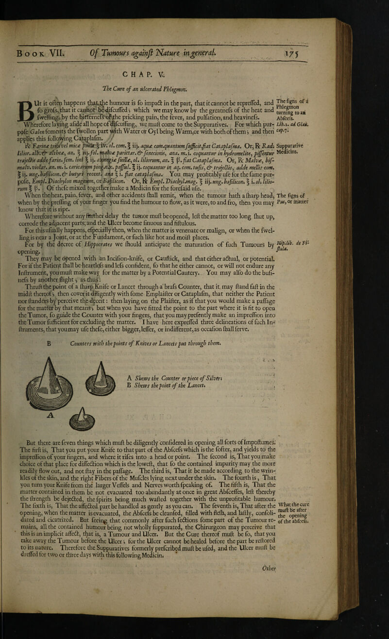 ■ C H A P. V; The Cure of an ulcerated Phlegmon, BUt it oftep happens humour is fo impad in the part, that it cannot be reprefled, and ^ fo grofs, that it canhp'f Sc-^cufred i which we may know by the greatnefs of the heat and turnfng°to zi fweilings' by the bittefnerS''br4:he pricking pain, the fever, and pulfation-, and heavinefs. Abfeefs. Wherefore laying afide all hope of^fculling, we muli come to the Suppuratives. For which put- Lib.z, ad Glad. ^ Galen foments the fwollen part ^th Water or Oyl being Warm,or with both of them j and then applies this following C^t^lafm. ■/ ^ ' Fam£ trtcivel mk£ iv. ol, com, ^ iij. aqu£ com.quantumfnfficitfiat 'Caiaflafma, Or, R Kad-, Suppurative ltlior,alb,& althe£^ an, 5 i\],fol,ptahj£parietar,&fenecioniSj ana.m.i, coquantur inhydromelite^ pijfeniur Meaicms. trajeffU addefarin,Jem. linl ^ ij, ai^ngi£fuill£^ ol, liliorum^ an, § \i,fiat Cataplajma, Or, R Malv£^ bif- malv, violar, an. m. i. caricarHmpini.n^,paJJul, ^ ij. coquantur in aq, com, tufis^ &jrajeflis^ adde mellis com. ^ i j. ung, bafilicon, & butyr^fecenut aria ^ i. fat cataplafma. You may profitably ufe for the fame pur- pol^ Empl. Diachylon magnim^ ov-Baftlicon, Or, R Pmpl. Diachylanag. ^ iij. ung, bajilicom | i. oh lilio- rwm I : Of thefe mixed together make a Medicin for the forefoid ufe., • — ' ' . When theheat, pain, fever, and other accidents lhall remit, when the tumour hath a fharp head, Thefignsof when by diepreffing of your finger you find the humour to flow, as it were, to and fro, then you may matter know that it is ripe. Wherefore without any ftirther delay the tumor muft be opened, left the matter too long ftiut up, corrode the adjacent parts, and the Ulcer become fitiuous and fiftulous. For thisufually happens, efpccially then, when the matter is venenate or malign, or when the fwel- ling is near a Joint, or at the Fundament, or fuch like hot and moift places. For by the decree oP Hippocrates we fhould anticipate the maturation of fuch Tumours opening. They may be bpened with an Incifion-knife, or Cauftick, and that either adual, or potential. For if the Patient lhall be hearties andlefs confident, fo that he either cannot, or will not endure any Inftrument, you muft make way for the matter by a Potential Cautery,. You may alfo do the bufi- nefs by another flight ^ as thus: Thruft the point of a fharp Knife or Lancet through a brafs Counter, that it, may ftand faft in the midft thereof*, then cover it diligently with fome Emplaifter or Cataplafin, that neither the Patient nor ftanders by perceive the deceit: then laying on the Plaifter, as if that you would make a paffage for the matter by that means but when you have fitted the point to the part where it is fit to open the Tumor, fo guide the Counter with your fingers, that you may prefcntly make an imprellion into theTumor fufficient for excluding the matter. I have here expreffed three delineations of fuch In- ftruments, that you may ufe thefe, either bigger, lefler, or indifferent, as occafion (hall fer ve. B Counters with the points of Knives or Lancets put through them. A Shews the Counter or piece of Silven B Shews the point of the Lanceti. But there are feven things which muft be diligently confidered in opening all forts of Impoftumes.' The firft is. That you put your Knife to that part of the Abfeefs which is the fofter, and yields to the imprellion of your fingers, and where it rifes into a head or point. The fecond is. That you make choice of that place for diffedion which is the loweft, that fo the contained impurity may the more readily flow out, and not ftay in the paffage. The third is. That it be made according to the wrin¬ kles of the skin, and the right Fibers of the Mufcles lying next under the skin. The fourth is, That you turn your Knife from the larger Veffels and Nerves worth fpeaking of. The fifth is, That the matter contained in them be not evacuated too abundantly at once in great Abfcclfes, left thereby theftrength be dejeded, thefpirits being much wafted together with the unprofitable humour. . The fixth is. That the affeded part be handled as gently as you can. The feventh is, That after the what the cure opening, when the matter is evacuated, the Abfeefs be cleanfed, filled with flefh, and laftly, confoli-opening dated and cicatrized. But feeii>g that commonly after fuch fedions fome part of the Tumour re- oftheabfcefeo mains, all the contained humour being not wholly fuppurated, the Chirurgeon may perceive that this is an implicit affed, that is, a Tumour and Ulcer. But the Cure thereof muft be fo, that you take away the Tumour before the Ulcer j for the Ulcer cannot be healed before the part be reftored to its nature. Therefore the Suppuratives formerly preferibed muft be ufed, and the Ulcer muft be dreffed for two or three days with this following Medicine HlpUib. dt Fl« ^ fiuU, Other