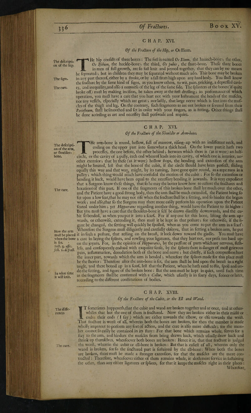 The defcripti- on of the hip. The figns. The cure. CHAP. XVI. ' I Of the FraUure of the Hip^ or Os Ilium. He hip confifts of three hopes : The firft is iiahied Os Ilhm^ the .haunch-bbhe •, the other, Os Ifchion^ the huckle-bone s the third, Os pubis, the (hare-bone. Thefe three bones _ in men of full growth, are fo fail: knit and joyned together, that they can by no means be feparated •, but in children they may be feparated without much ado. This bone may be broken in any part thereof, either by a hroke, or by a fall from high upon any hard body. You lhall know the fra(^ure by the (ame kind of figns, as you know others, to wit, pain, pricking, a deprefled cavi¬ ty, and inequality,and alfo i numnefs of the leg of the fame fide. The fplinters of the bones (if quite broke offj muft by making incifion, be taken away at the firft dteiling, in performance of which operation, you miift have a cafe that you hurt not with your Inftrument the heads of the mufcles, nor any velfels, efpecially which are great 5 norlafily, that large nerve which is fent into the muf¬ cles of the thigh and leg. On the contrary, fuch fragments as are not broken or fevered from their Fertofteum^ (hall befmoothed and fet in order with your fingers, as is fitting. Other things (hall be done aedrding as art and neceffity (hall perfwade and require. The deferipti- on of the arm, or fhouldcr- boiie. The cure. How the arm mult be placed when the bone is fct. Se£l. 5. effic. /iff. I* dejraEl. In what time it will knit. CHAP. XVI. t, Of the FraUure of the Shoulder or Arm-bohei THe artp-bone is round, hollow, full of marrow, rifi«g-up with an indifferent neck, and ending on the upper part into fomewhat a thick head. On the lower part it hath two procefleS, the one before, the other behind v between which there is it were) an half¬ circle, or the cavity of a pully, each end whereof leads into its cavity, of whkh one is interior, an^ other exterior •, that by thefe (as it were) hollow flops, the bending and extenfion of the arm might be limited, lefl that the bone of the cubit, if the circle fhould have been perfedl. Aiding equally this way and that way, might, by its turning, have gone quite round, as a rope runs in a pulley f) which thing would much have confufed the motion of the cubit: For fo the extenfion or bending it back, would have been equal to the neceflary bending it inwards. Itis very expedient that a Surgeon know thefe things, that fb he may the better know how to reflore the fractures and luxations of this part. If one of the fragments of this broken bone fliall lye much over the other, and the Patient have a good flfong body, then the arm lhall be much extended, the Patient being fo fet upon a low feat,that he may not rife when the fradure lhall be a fetting, and fo hinder the begun work 5 and alfo,that fo the Surgeon may there more eafily perform his operation upon the Patient feated under him •, yet Hippocrates regarding another thing, would have the Patient to fit higher : But ybu mufl have a care that the Ihoulder-bone it felf be drawn diredly downwards, and the cu¬ bit fo bended, as when you put it intoafearf. For if anyone fet this bone, lifting the arm up¬ wards, or ctherwife, extending it, then mufl it be kept in that poflure i for otherwife, if the fi¬ gure be changed, the fetting will quickly be fpoiled, when as you come to put the arm in a fcarf: Wherefore the Surgeon mufl diligently and carefully obferve, that in fetting a broken arm, he put it in fuch a poflure, that refling on the breafl, it look down toward the girdle. You mufl have a care in laying the fplints, and rowling your ligatures, that they hurt not, nor prefs too hard up¬ on the joynts. For, in the opinion of Hippocrates^ by the preffare of parts which are nervous, flelh- lefs, and confequently endued with exquilite fenfe, by the fplints there is danger of mofl grievous pain, inflammation, denudation both of the bone and nerve i but chiefly, if fuch comprellion hurt the inner part, towards which the arm is bended , wherefore the Iplints made for this place muft be the Ihorter: Therefore after the arm-bone is fet, the arm lhall be laid upon the breafl in a right angle, and there bound up in a fcarf, left that the Patient, when he hath need to ftir, fpoil and un¬ do the fetting, and figure of the broken bone : But the arm mufl be kept in quiet, until fuch time as the fragments lhall be confirmed with a Callus^ which ufually is in forty days, fooner or later, according to the different conflitutions of bodies. The diffe¬ rences The cure. CHAP. XVIII. Of the Fracture of the Cubit^ or the EU and IFand. T fometimes happeneth,that the cubit and wand are broken together and at once, and at other- whiles that but the one of them is fradfured. Now they are broken either in their midfl or ends’, their ends (I fay) which are either towards the elbow, or elfetowards the wrifl. That fradlure is worfl of all, wherein both the bones are broken, for then the member is made wholly impotent to perform any fort of adtion, and the cure is alfo more difficult •, for the mem¬ ber cannot fo eafily be contained in its ftate: For that bone which remains whole, fervesfor a flay to the arm, and hinders the mufcles from being drawn back, which ufually draw back and Ihrink up themfelves, whenfoever both bones are broken: Hence it is, that that Iradture is judged the worfl, wherein the cubit or ell-bone is broken: But that is eafieft of all, wherein only the wand is broken, tor fo the fradfured part is fuflained by the ell-bone: When both the bones are broken, there mufl be made a flronger extenfion, tor that the mufcles are the more con- tradfed : Therefore, whenfoever either of them remains whole, it doth more fervice in tuftaining the ocher, than any either ligatures or fplints, for that it keeps the mufcles right in their places: Wherefore. :i