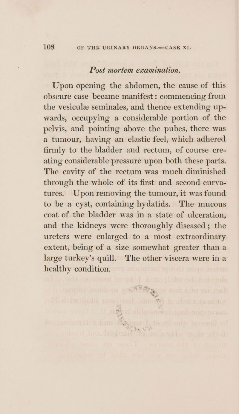 Post mortem examination. Upon opening the abdomen, the cause of this obscure case became manifest : commencing from the vesiculz seminales, and thence extending up- wards, occupying a considerable portion of the pelvis, and pointing above the pubes, there was a tumour, having an elastic feel, which adhered firmly to the bladder and rectum, of course cre- ating considerable pressure upon both these parts. The cavity of the rectum was much diminished through the whole of its first and second curva- tures. Upon removing the tumour, it was found to be a cyst, containing hydatids. ‘The mucous coat of the bladder was in a state of ulceration, and the kidneys were thoroughly diseased ; the ureters were enlarged to a most extraordinary extent, being of a size somewhat greater than a large turkey’s quill. The other viscera were in a healthy condition.