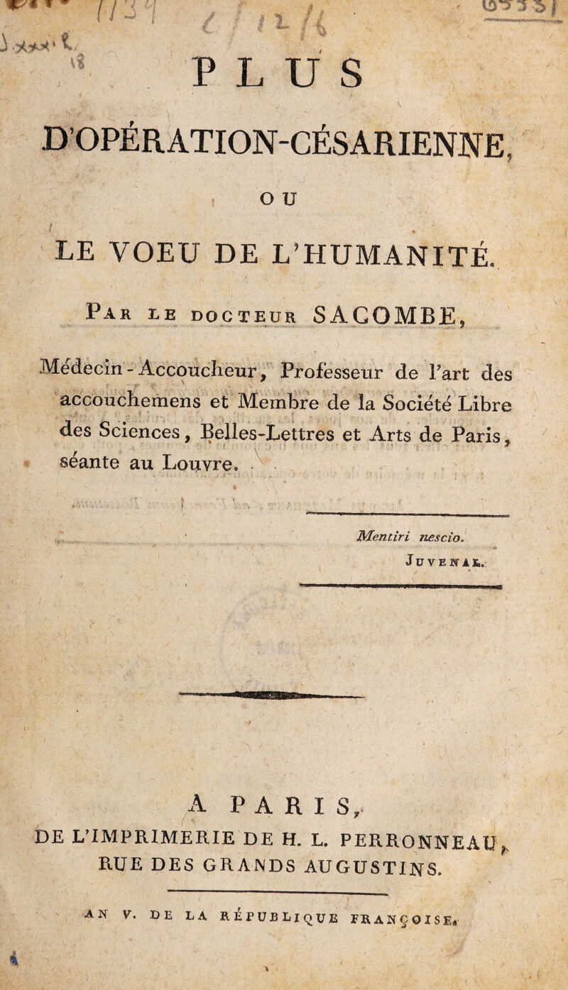 , PLUS I ' - V D’OPÉRATION-CÉSARIENNE, O U LE VOEU DE L'HUMANITÉ. Par le docteur SÂCOMBE, Médecin-Accoucheur, Professeur de Fart des accouchemens et Membre de la Société Libre des Sciences, Belles-Lettres et Arts de Paris, séante au Louvre. 3Men tiri nés cio. JüVENil,,: A PARIS, DE L’IMPRIMERIE DE H. L. PERRONNEAU h RUE DES GRANDS AUGUSTINS. AN V. DE LA REPUBLIQUE FRANÇOISE*