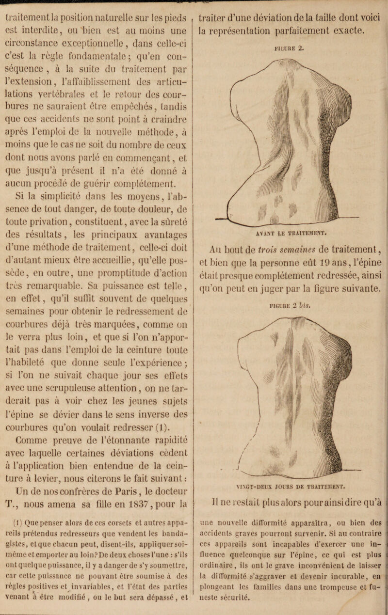 traitement la position naturelle sur les pieds est interdite, ou bien est au moins une circonstance exceptionnelle, dans celle-ci c’est la règle fondamentale; qu’en con¬ séquence , à la suite du traitement par l’extension, l’affaiblissement des articu¬ lations vertébrales et le retour des cour¬ bures ne sauraient être empêchés, tandis que ces accidents ne sont point à craindre après l’emploi de la nouvelle méthode, à moins que le cas ne soit du nombre de ceux dont nous avons parlé en commençant, et que jusqu’à présent il n’a été donné à aucun procédé de guérir complètement. Si la simplicité dans les moyens, l’ab¬ sence de tout danger, de toute douleur, de toute privation, constituent, avec la sûreté des résultats, les principaux avantages d’une méthode de traitement, celle-ci doit d’autant mieux être accueillie, qu’elle pos¬ sède, en outre, une promptitude d’action très remarquable. Sa puissance est telle, en effet, qu’il suffit souvent de quelques semaines pour obtenir le redressement de courbures déjà très marquées, comme on le verra plus loin, et que si l’on n’appor¬ tait pas dans l’emploi de la ceinture toute l’habileté que donne seule l’expérience ; si l’on ne suivait chaque jour ses effets avec une scrupuleuse attention, on ne tar¬ derait pas à voir chez les jeunes sujets l’épine se dévier dans le sens inverse des courbures qu’on voulait redresser (1). Comme preuve de l’étonnante rapidité avec laquelle certaines déviations cèdent à l’application bien entendue de la cein¬ ture à levier, nous citerons le fait suivant : Un de nos confrères de Paris, le docteur T., nous amena sa tille en 1837, pour la (1) Que penser alors de ces corsets et autres appa¬ reils prétendus redresseurs que vendent les banda- gistes, etque chacun peut, disent-ils, appliqucrsoi- mêmeet emporter au loinPDc deux choses l’une : s’ils ont quelque puissance, il y a danger de s’y soumettre, car cette puissance ne pouvant être soumise à des règles positives et invariables, et l’état des parties r(- ^ venant à être modifié, ou le but sera dépassé, et traiter d’une déviation de la taille dont voici la représentation parfaitement exacte. FIGURE 2. Au bout de trois semaines de traitement, et bien que la personne eut 19 ans, l’épine était presque complètement redressée, ainsi qu'on peut en juger par la figure suivante. FIGURE 2 bis. Il ne restait plus alors pour ainsi dire qu’à une nouvelle difformité apparaîtra, ou bien des accidents graves pourront survenir. Si au contraire ces appareils sont incapables d’exercer une in- lluence quelconque sur l’épine, ce qui est plus ordinaire, ils ont le grave inconvénient de laisser la difformité s’aggraver et devenir incurable, en plongeant les familles dans une trompeuse et fu¬ neste sécurité.