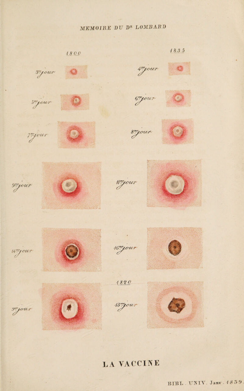 MEMOIRE DU DK LOMBARD 18 00 188 5 A'you'r ô'u^OrU'r LA VACCINE BIBL . TINIV. Janv .'18 39