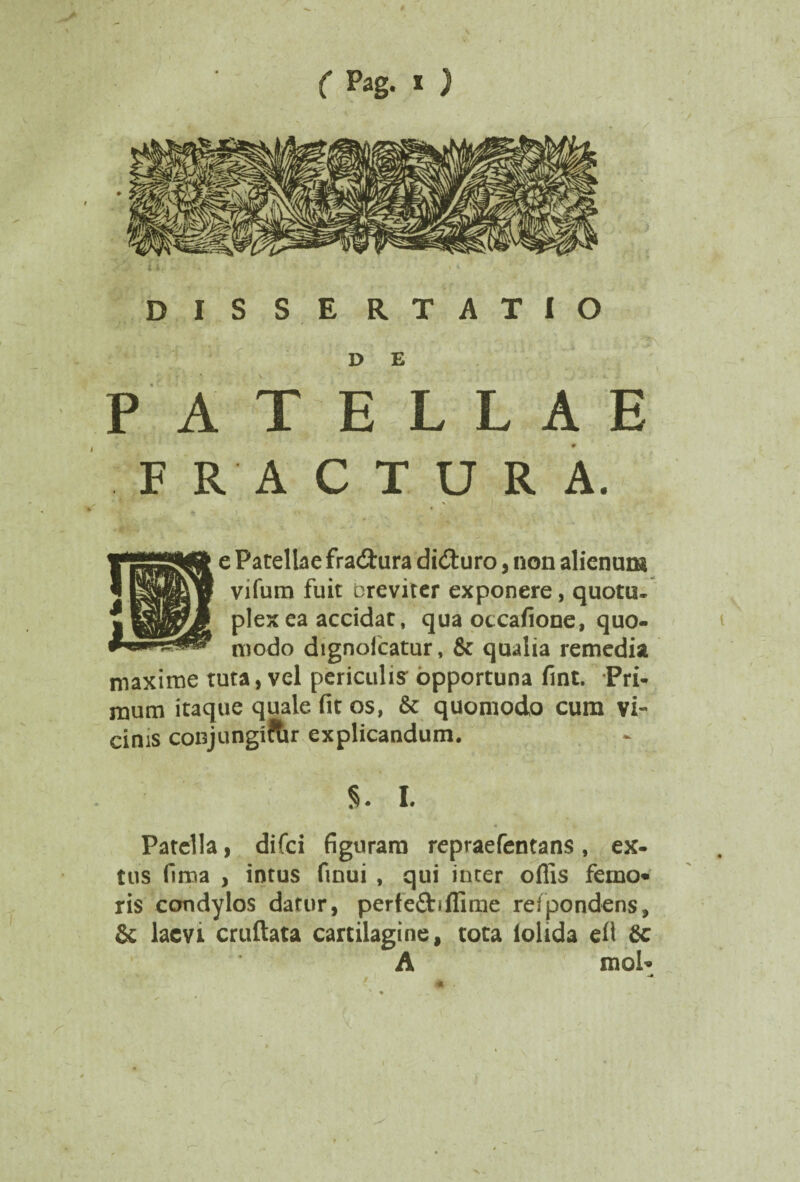 ( Pag. * ) DISSERTATIO D E PATELLAE FRACTURA. e Patellae fraitura diituro, non alienum vifum fuit breviter exponere, quotu- plex ea accidat, quaotcafione, quo¬ modo dignolcatur, & qualia remedia maxime tuta, vel periculis opportuna fint. Pri¬ mum itaque quale, fit os, & quomodo cum vi¬ cinis conjungitur explicandum. 5. I. Patella, difci figuram repraefentans, ex- tus fima , intus finui , qui inter offis femo«' ris condylos datur, perfeftiffime refpondens, & laevi cruftata cartilagine, tota iolida ei) &c A mol»