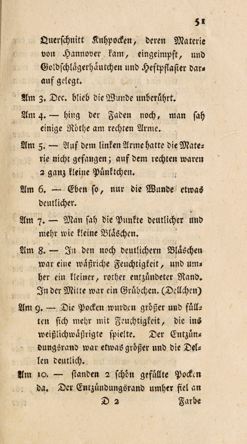 5« ßuerfchttitt ßithpocfen, berett Materie m\ Jpanmmer f’am, eingeimpft, unb djolbfc^lagevOautchen unb $eftpflajter Dar« aufgelegt •» 2lm 3♦ £5ec» blieb bie ©unbe unberührt 21m 4,~ hing bei* gaben noch# man fah einige Sütbtfje am rechten 2lrme» 2lm 5. — 2(uf bem litten 2lrme hatte bie^Rate* rie nicht gefangen; auf bem rechten mären 2 gan$ fletne 9>unftchetu 2lm 6* — dbm fo, nur bie ©unbe etma$ betulicher* . 4 #, _ • y • 2fm 7* — ©an fah bie fünfte betulicher mtb mehr mie Heine 23lägchcm 21m 8* — 3n beit noch beutlichern SSlaSchen mar eine mdßriche geuc^tigfeit, unb ums her ein Heiner, votier ent^fmbeter Sftanb«. 3n ber ©itte mar ein ©rubchen* (Teilchen) 2lm 9* — £)ie ^ocf’en mürben großer unb füll* ten ftch mel;r mit geuchtigfeit, bie ins meiflichmaßrigte fyielte» £)er ©ntjun* bungeranb mar etmaä großer unb bie £>et len betulich» tim 10. — fianben 2 fchott gefüllte Reefen bat £)ev ^nt^unbungbranb umher fiel an