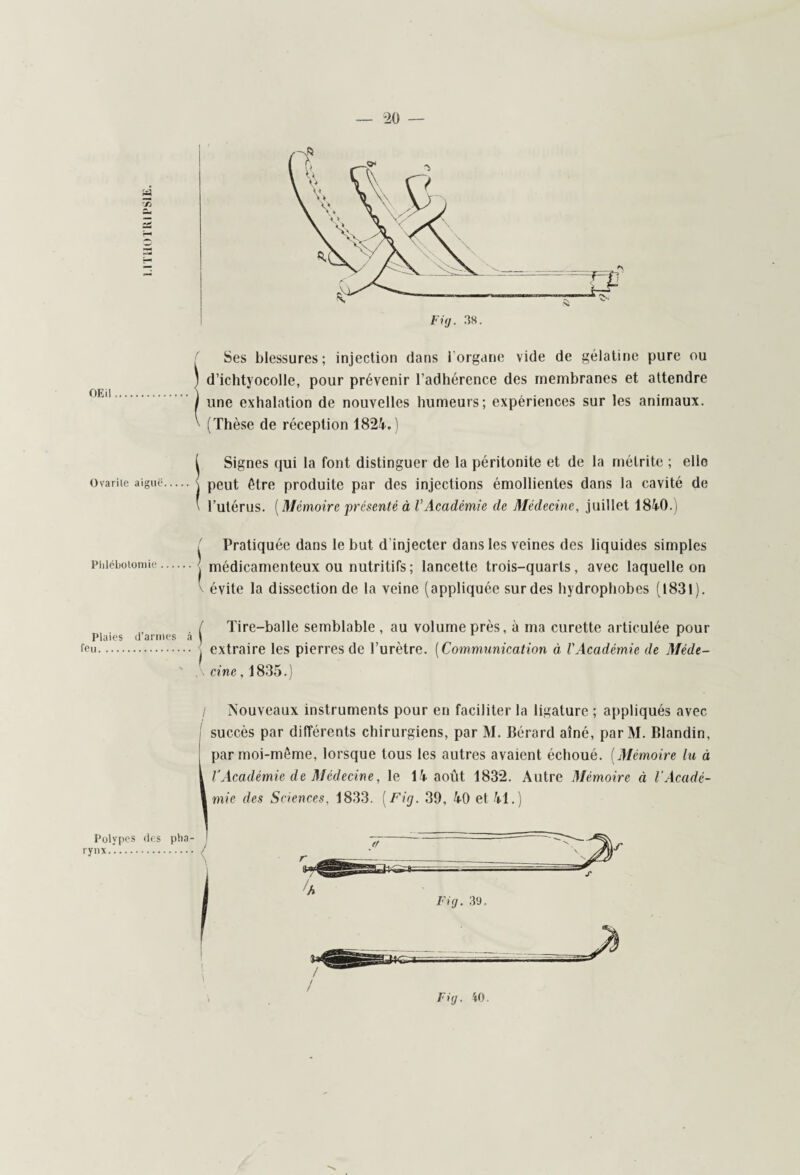 OEil Ovarite aiguë Phlébotomie Pluies d'armes à feu. Polvpes des pha¬ rynx. . Ses blessures; injection dans l'organe vide de gélatine pure ou ! d’ichtyocolle, pour prévenir l’adhérence des membranes et attendre I une exhalation de nouvelles humeurs; expériences sur les animaux. ^ (Thèse de réception 1824.) I Signes qui la font distinguer de la péritonite et de la mélrite ; elle j peut être produite par des injections émollientes dans la cavité de l’utérus. [Mémoire 'présenté à VAcadémie de Médecine, juillet 1840.) * Pratiquée dans le but d injecter dans les veines des liquides simples médicamenteux ou nutritifs; lancette trois-quarts, avec laquelle on v évite la dissection de la veine (appliquée sur des hydrophobes (1831). / Tire-balle semblable , au volume près, à ma curette articulée pour , extraire les pierres de l’urètre. ( Communication à l'Académie de Méde¬ cine , 1835.) / Nouveaux instruments pour en faciliter la ligature ; appliqués avec succès par différents chirurgiens, par M. Bérard aîné, parM. Blandin, i par moi-même, lorsque tous les autres avaient échoué. [Mémoire lu à i VAcadémie de Médecine, le 14 août 1832. Autre Mémoire à l'Acadé- \mie des Sciences, 1833. (Fig. 39, 40 et 41.) \