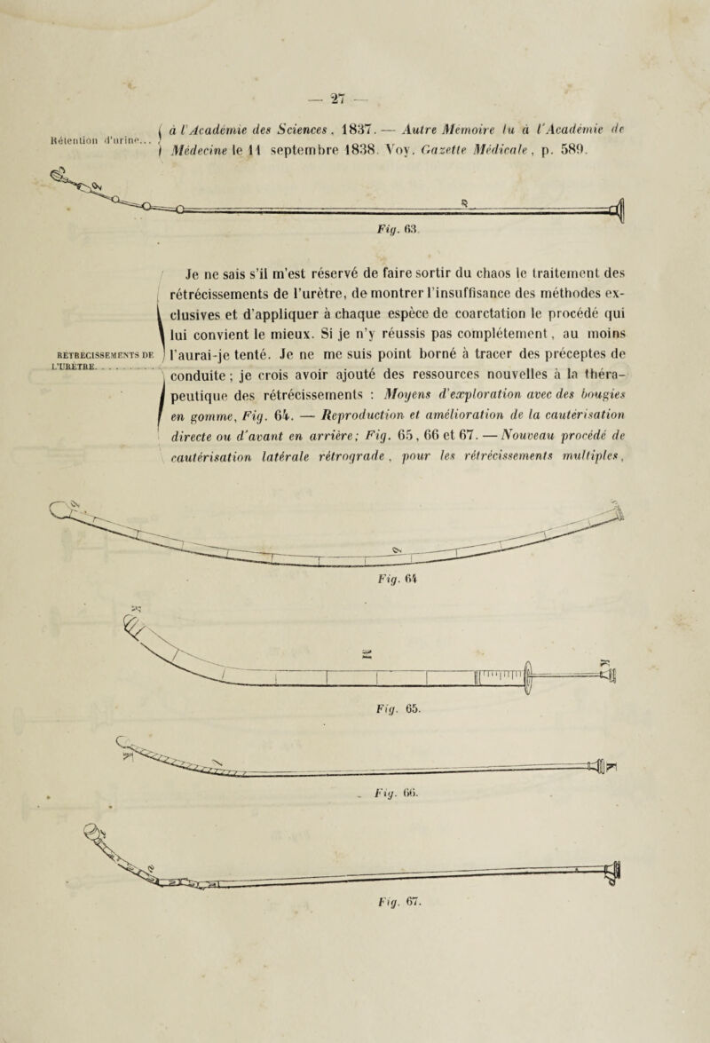 21 Rétention d’urine... | à l’Académie des Sciences, 1837.— Autre Mémoire lu à l'Académie de ) Médecine le il septembre 1838. Voy. Gazette Médicale, p. 580. . —■ ■ =4 Fig. 63. Je ne sais s’il m’est réservé de faire sortir du chaos le traitement des rétrécissements de l’urètre, de montrer l’insuffisance des méthodes ex- 1 clusives et d’appliquer à chaque espèce de coarctation le procédé qui 1 lui convient le mieux. Si je n’y réussis pas complètement, au moins retbecissementsdf. ] l’aurai-je tenté. Je ne me suis point borné à tracer des préceptes de uu ntu conduite; je crois avoir ajouté des ressources nouvelles à la théra- I peutique des rétrécissements : Moyens d’exploration avec des bougies 1 en gomme, Fig. 64. — Reproduction et amélioration de la cautérisation directe ou d'avant en arrière; Fig. 65,66 et 67. — Nouveau procédé de cautérisation latérale rétrograde , pour les rétrécissements multiples, _ _ Fig. 06. Fkj. 67.