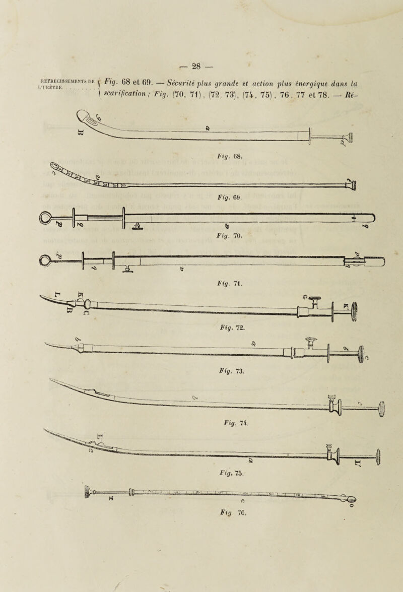 ) Fig. 68 et 69. —Sécurité plus grande et action plus énergique dans la ' ! scarification ; Fig. (70, 71), (72, 73), (74, 75), 76, 77 et 78. — Ré- Fig. 71. Fig. 73. Fig 70, o