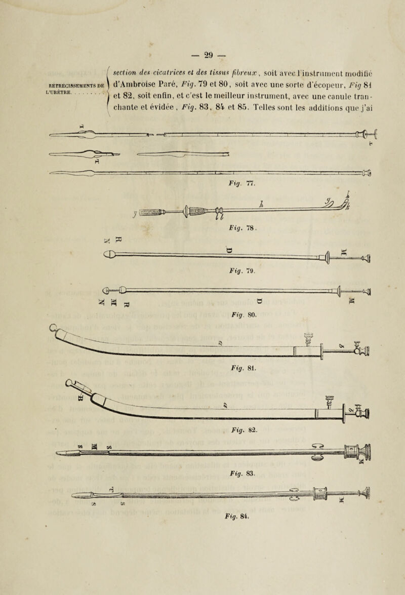 RETRECISSEMENTS DE L’URÈTRE. / section des cicatrices et des tissus fibreux, soit avec 1 instrument modifié \ d'Ambroise Paré, Fig. 79 et 80, soit avec une sorte d’écopeur, Fig 8f I et 82, soit enfin, et c'est le meilleur instrument, avec une canule tran- • chante et évidée , Fig. 83, 84 et 85. Telles sont les additions que j’ai T 3 Fig. 77. Fig. 79. P <3—Ci- —. ... ■ - 3 S 3 Fig. 80- a (JS » Fig. 84,