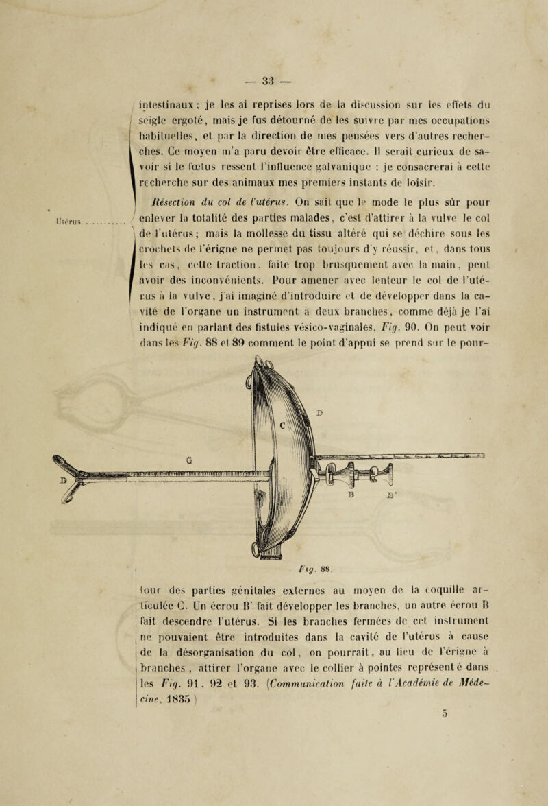 intestinaux : je les ai reprises lors de la discussion sur les effets du seigle ergoté, mais je fus détourné de les suivre par mes occupations habituelles, et par la direction de mes pensées vers d’autres recher¬ ches. Ce moyen m’a paru devoir être efficace. Il serait curieux de sa¬ voir si le fœlus ressent l’influence galvanique : je consacrerai à cette recherche sur des animaux mes premiers instants de loisir. Résection du col de l'utérus. On sait que le mode le plus sûr pour enlever la totalité des parties malades, c’est d’attirer à la vulve le col de l’utérus; mais la mollesse du tissu altéré qui se déchire sous les crochets de i’érigne ne permet pas toujours d’y réussir, et, dans tous les cas, cette traction, faite trop brusquement avec la main, peut avoir des inconvénients. Pour amener avec lenteur le col de l’uté¬ rus à la vulve, j'ai imaginé d’introduire et de développer dans la ca¬ vité de l'organe un instrument à deux branches, comme déjà je l’ai indiqué en parlant des fistules vésico-vaginales, Fig. 90. On peut voir dans les Fig. 88 et 89 comment le point d’appui se prend sur le pour- G OTrarï^wmnniimiïïitirrwnnfffniiï(mnm^ /' «</. 88. tour des parties génitales externes au moyen de la coquille ar¬ ticulée G. Un écrou H’ fait développer les branches, un autre écrou H fait descendre l’utérus. Si les branches fermées de cet instrument ne pouvaient être introduites dans la cavité de l’utérus à cause de la désorganisation du col, on pourrait, au lieu de l’érigne à branches , attirer l’organe avec le collier à pointes représenté dans les Fig. 91, 92 et 93. (Communication faite à l’Académie de Méde¬ cine. 1835 ) 5