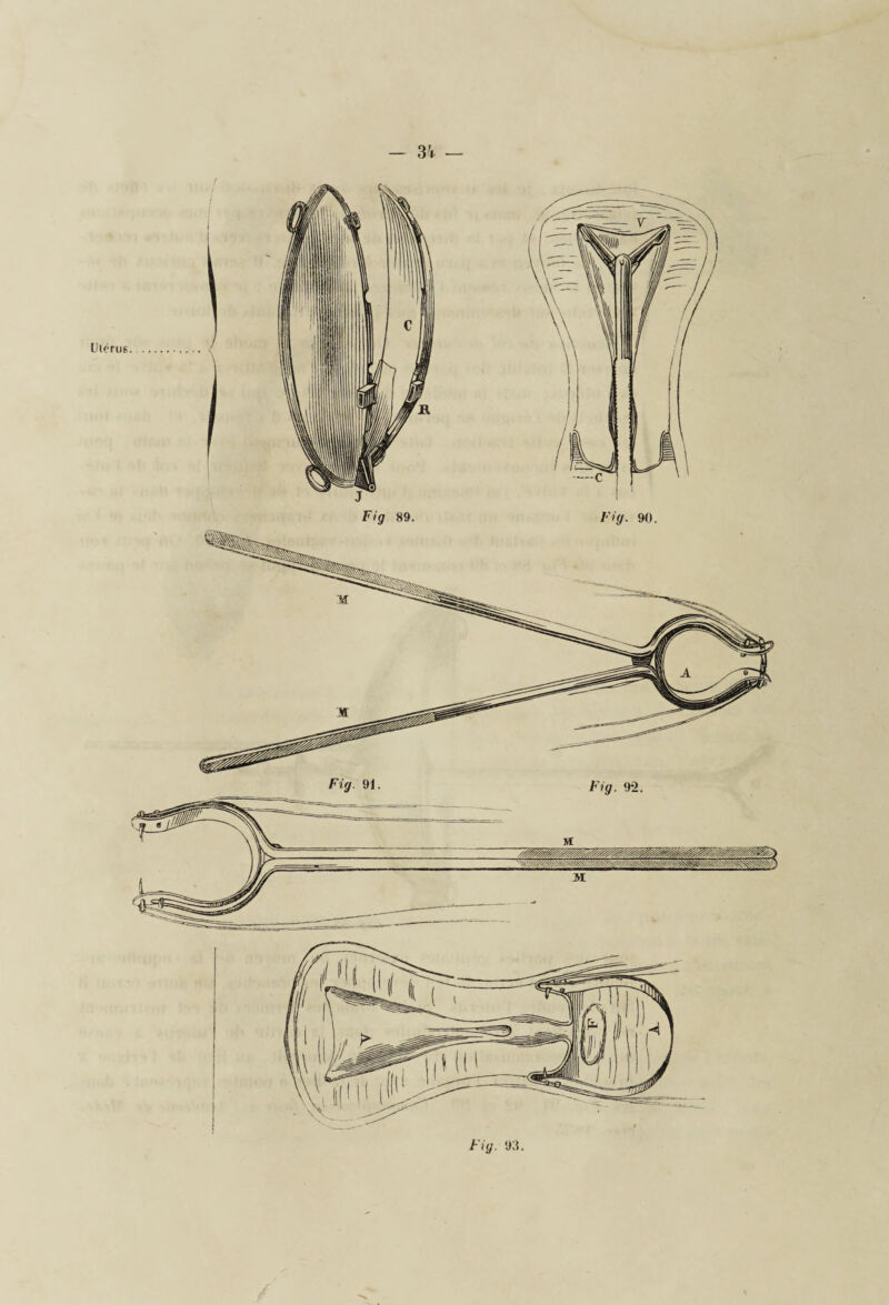 — 3 V — Fig. i);î.