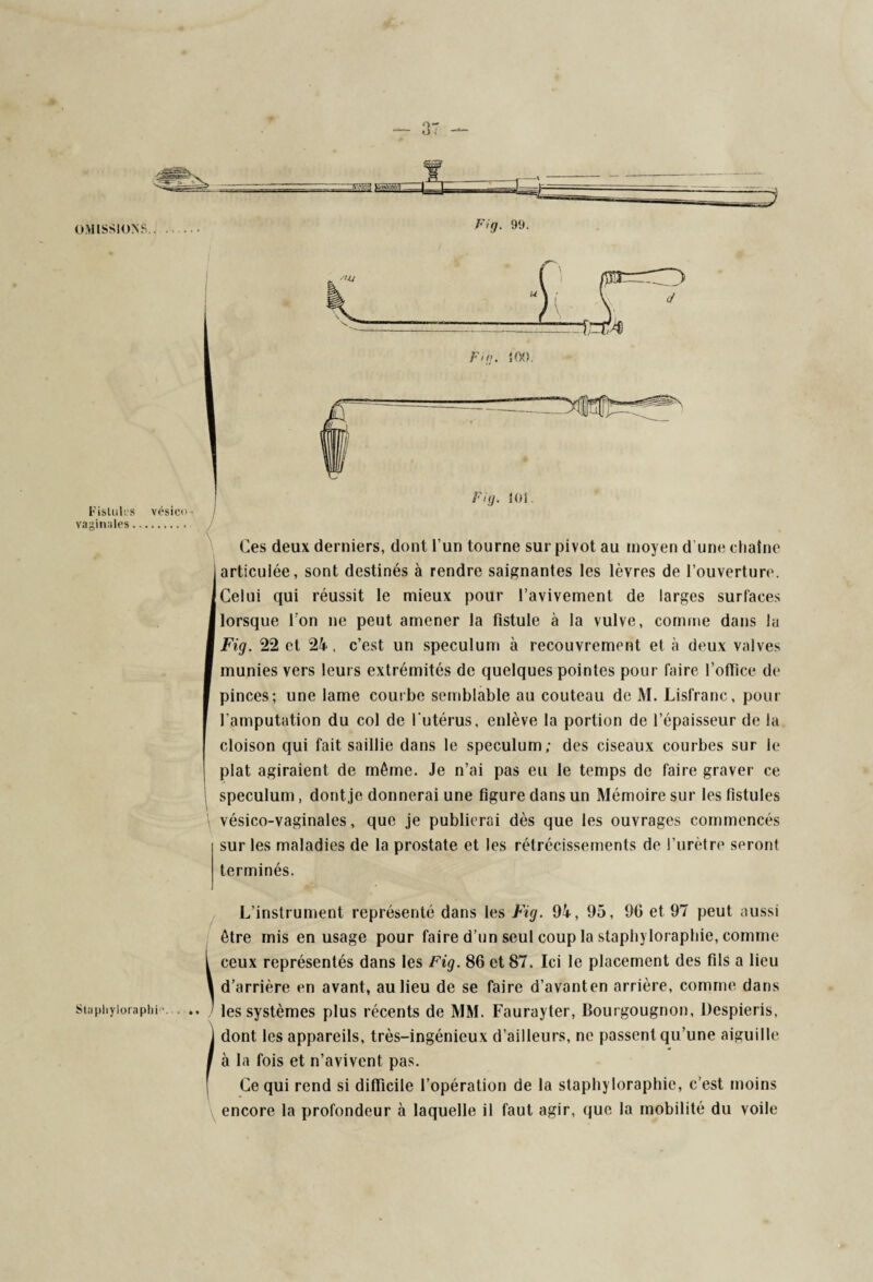 Fistules vaginales. vésico - Fit 100. Fig. 101. Ces deux derniers, dont l’un tourne sur pivot au moyen d une chaîne articulée, sont destinés à rendre saignantes les lèvres de Couverture. Celui qui réussit le mieux pour l’avivement de larges surfaces lorsque Ion ne peut amener la fistule à la vulve, comme dans lu Fig. 22 et 24, c’est un spéculum à recouvrement et à deux valves munies vers leurs extrémités de quelques pointes pour faire l'office de pinces; une lame courbe semblable au couteau de M. Lisfranc, pour l’amputation du col de l'utérus, enlève la portion de l’épaisseur de la cloison qui fait saillie dans le spéculum; des ciseaux courbes sur le plat agiraient de même. Je n’ai pas eu le temps de faire graver ce spéculum , dont je donnerai une figure dans un Mémoire sur les fistules \ vésico-vaginales, que je publierai dès que les ouvrages commencés sur les maladies de la prostate et les rétrécissements de l’urètre seront terminés. L’instrument représenté dans les Fig. 94, 95, 90 et 97 peut aussi être mis en usage pour faire d’un seul coup la staphyloraphie, comme i ceux représentés dans les Fig. 86 et 87. Ici le placement des fils a lieu \ d’arrière en avant, au lieu de se faire d’avanten arrière, comme dans staphyioraphi». . / les systèmes plus récents de MM. Faurayter, lîourgougnon, Despieris, J dont les appareils, très-ingénieux d’ailleurs, ne passent qu’une aiguille I à la fois et n’avivent pas. Ce qui rend si difficile l’opération de la staphyloraphie, c’est moins encore la profondeur à laquelle il faut agir, que la mobilité du voile