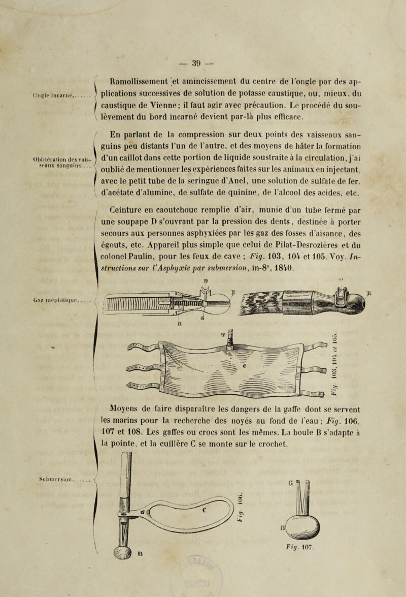 , Ramollissement et amincissement du centre de l'ongle par des ap- ongieincarné. ' plications successives de solution de potasse caustique, ou, mieux, du I caustique de Vienne; il faut agir avec précaution. Le procédé du sou¬ lèvement du bord incarné devient par-là plus efficace. seaux sanguins. En parlant de la compression sur deux points des vaisseaux san¬ guins peu distants l’un de l’autre, et des moyens de hâter la formation Obiitéraiion des vais- ) d’un caillot dans cette portion de liquide soustraite à la circulation, j’ai ' ' j oublié de mentionner les expériences faites sur les animaux en injectant. J avec le petit tube de la seringue d’Anel, une solution de sulfate de fer. \ d’acétate d’alumine, de sulfate de quinine, de l’alcool des acides, etc. Ceinture en caoutchouc remplie d’air, munie d’un tube fermé par une soupape D s’ouvrant par la pression des dents, destinée à porter secours aux personnes asphyxiées par les gaz des fosses d’aisance, des égouts, etc. Appareil plus simple que celui de Pilat-Desrozières et du colonel Paulin, pour les feux de cave ; Fig. 103, 104 et 105. Voy. In¬ structions sur VAsphyxie par submersion, in-8°, 1840. (iaz méphitique.. Submersion Moyens de faire disparaître les dangers de la gaffe dont se servent les marins pour la recherche des noyés au fond de l’eau; Fig. 106. 107 et 108. Les gaffes ou crocs sont les mêmes. La boule B s’adapte à la pointe, et la cuillère C se monte sur le crochet.