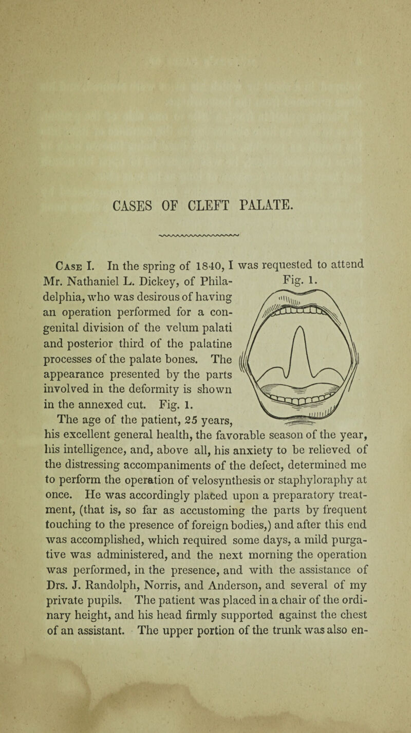 CASES OF CLEFT PALATE. Case I. In the spring of 1840,1 was requested to attend Mr. Nathaniel L. Dickey, of Phila- Fig- 1. delphia, who was desirous of having an operation performed for a con¬ genital division of the velum palati and posterior third of the palatine processes of the palate bones. The appearance presented by the parts involved in the deformity is shown in the annexed cut. Fig. 1. The age of the patient, 25 years, his excellent general health, the favorable season of the year, his intelligence, and, above all, his anxiety to be relieved of the distressing accompaniments of the defect, determined me to perform the operation of velosynthesis or staphyloraphy at once. He was accordingly placed upon a preparatory treat¬ ment, (that is, so far as accustoming the parts by frequent touching to the presence of foreignbodies,) and after this end was accomplished, which required some days, a mild purga¬ tive was administered, and the next morning the operation was performed, in the presence, and with the assistance of Drs. J. Randolph, Norris, and Anderson, and several of my private pupils. The patient was placed in a chair of the ordi¬ nary height, and his head firmly supported against the chest of an assistant. The upper portion of the trunk was also en-