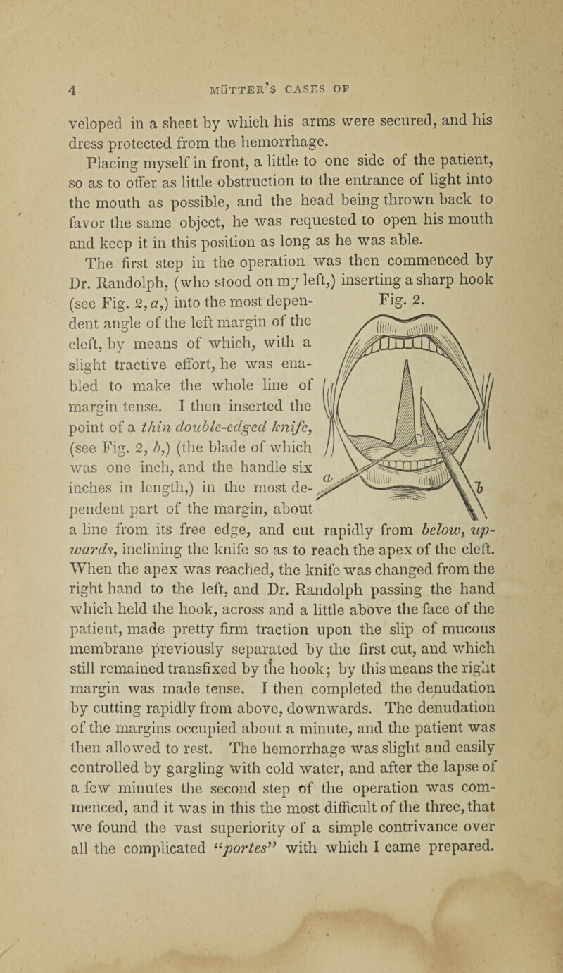 veloped in a sheet by which his arms were secured, and his dress protected from the hemorrhage. Placing myself in front, a little to one side of the patient, so as to offer as little obstruction to the entrance of light into the mouth as possible, and the head being thrown back to favor the same object, he was requested to open his mouth and keep it in this position as long as he was able. The first step in the operation was then commenced by Dr. Randolph, (who stood on my left,) inserting a sharp hook (see Fig. 2, or,) into the most depen- Fig. 2. dent angle of the left margin of the cleft, by means of which, with a slight tractive effort, he was ena¬ bled to make the whole line of margin tense. I then inserted the point of a thin double-edged knife, (see Fig. 2, h,) (the blade of which was one inch, and the handle six inches in length,) in the most de¬ pendent part of the margin, about a line from its free edge, and cut rapidly from below, up¬ wards, inclining the knife so as to reach the apex of the cleft. When the apex was reached, the knife was changed from the right hand to the left, and Dr. Randolph passing the hand which held the hook, across and a little above the face of the patient, made pretty firm traction upon the slip of mucous membrane previously separated by the first cut, and which still remained transfixed by tlie hook; by this means the right margin was made tense. I then completed the denudation by cutting rapidly from above, downwards. The denudation of the margins occupied about a minute, and the patient was then allowed to rest. The hemorrhage was slight and easily controlled by gargling with cold water, and after the lapse of a few minutes the second step of the operation was com¬ menced, and it was in this the most difficult of the three, that we found the vast superiority of a simple contrivance over all the complicated uportesi>> with which I came prepared.