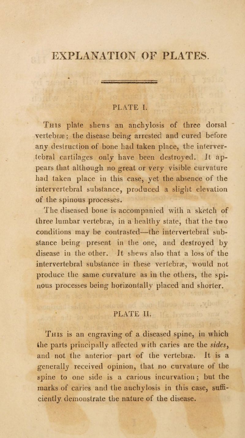 EXPLANATION OF PLATES. PLATE I. This plate shews an anchylosis of three dorsal vertebrae; the disease being arrested and cured before any destruction of bone had taken place, the interver¬ tebral cartilages only have been destroyed. Jt ap¬ pears that although no great or very visible curvature had taken place in this case, yet the absence of the intervertebral substance, produced a slight elevation of the spinous processes. The diseased bone is accompanied with a sketch of three lumbar vertebrae, iii a healthy state, that the two conditions may be contrasted—the intervertebral sub¬ stance being present in the one, and destroyed by disease in the other. Jt shews also that a loss of the intervertebral substance in these vertebrae, would not produce the same curvature as in the others, the spi¬ nous processes being horizontally placed and shorter. PLATE II. This is an engraving of a diseased spine, in which the parts principally affected with caries are the sides, and not the anterior part of the vertebrae. It is a generally received opinion, that no curvature of the spine to one side is a carious incurvation; but the marks of caries and the anchylosis in this case, suffi¬ ciently demonstrate the nature of the disease.
