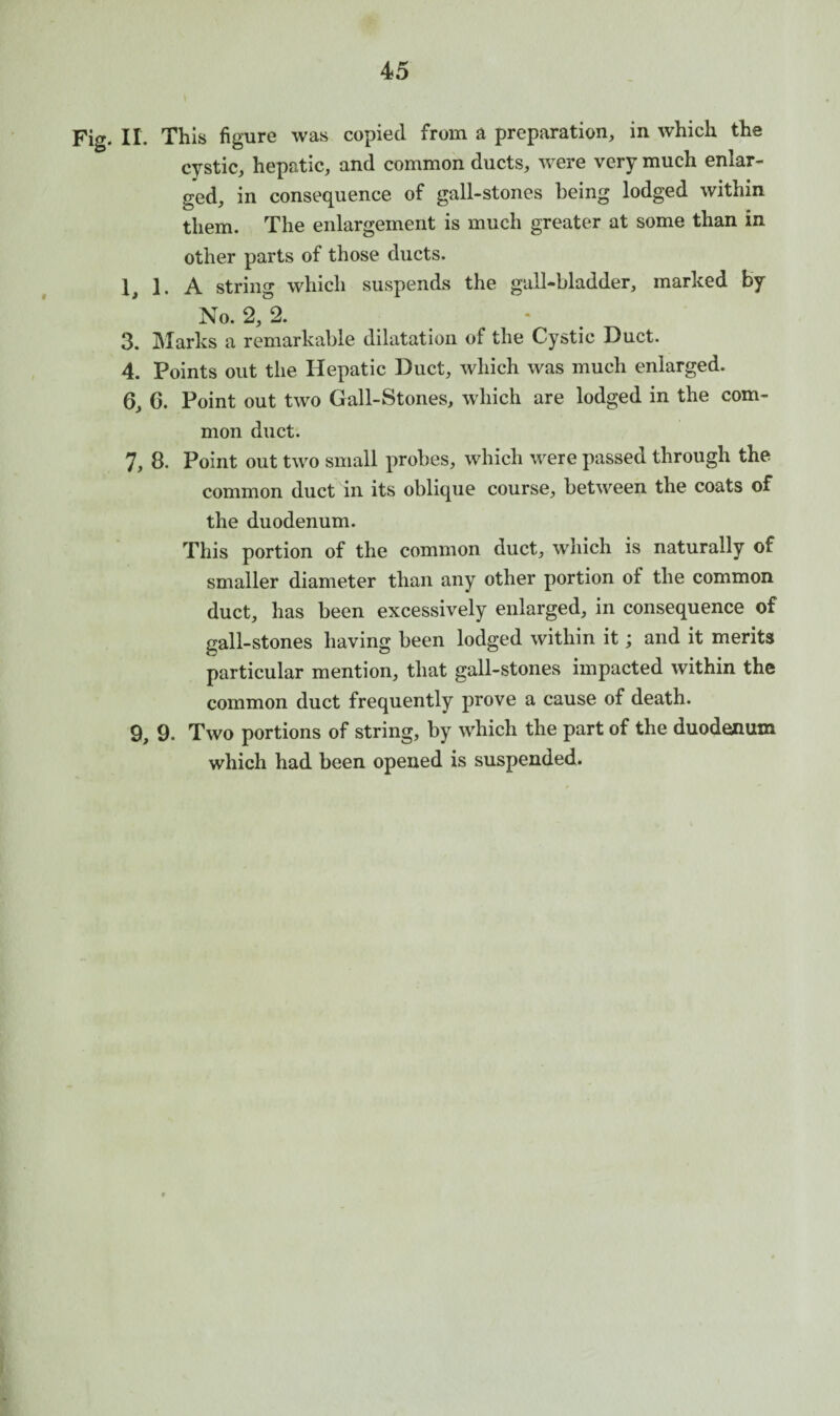 Fig. II. This figure was copied from a preparation, in which the cystic, hepatic, and common ducts, were very much enlar¬ ged, in consequence of gall-stones being lodged within them. The enlargement is much greater at some than in other parts of those ducts. 1, 1. A string which suspends the gall-bladder, marked by No. 2, 2. - 3. Marks a remarkable dilatation of the Cystic Duct. 4. Points out the Hepatic Duct, which was much enlarged. 6, 6. Point out two Gall-Stones, which are lodged in the com¬ mon duct. 7, 8. Point out two small probes, which were passed through the common duct in its oblique course, between the coats of the duodenum. This portion of the common duct, which is naturally of smaller diameter than any other portion of the common duct, has been excessively enlarged, in consequence of gall-stones having been lodged within it; and it merits particular mention, that gall-stones impacted within the common duct frequently prove a cause of death. 9, 9. Two portions of string, by which the part of the duodenum which had been opened is suspended.