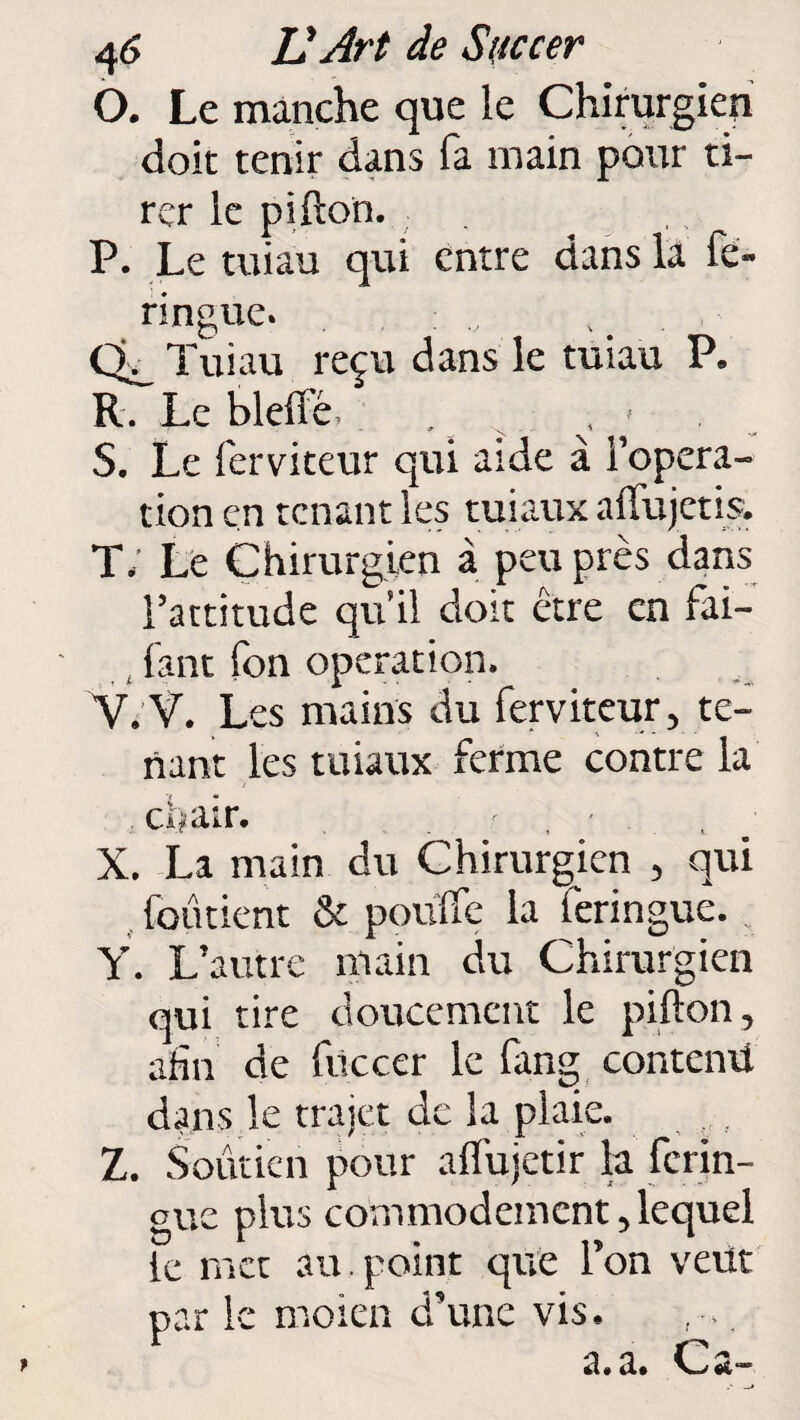 O. Le manche que le Chirurgien doit tenir dans fa main pour ti¬ rer le pifton. P. Le tuiau qui entre dans la fe- ringue. Cb_ Tuiau reçu dans le tuiau P. R. Le bielle, . _ . . > . S. Le ferviteur qui aide à l’opera¬ tion en tenant les tuiaux alfujetis. T; Le Chirurgien à peu près dans l’attitude qu’il doit être en fai— fant fon operation. V. V. Les mains du ferviteur, te¬ nant les tuiaux ferme contre la chair. • ; • X. La main du Chirurgien , qui fondent & poulie la feringue. Y. L’autre main du Chirurgien qui tire doucement le pillon, afin de fuccer le fang contenü dans le trajet de la plaie. Z. Soutien pour alïujetir la ferin¬ gue plus commodément, lequel le met au . point que l’on veut par le moien d’une vis.