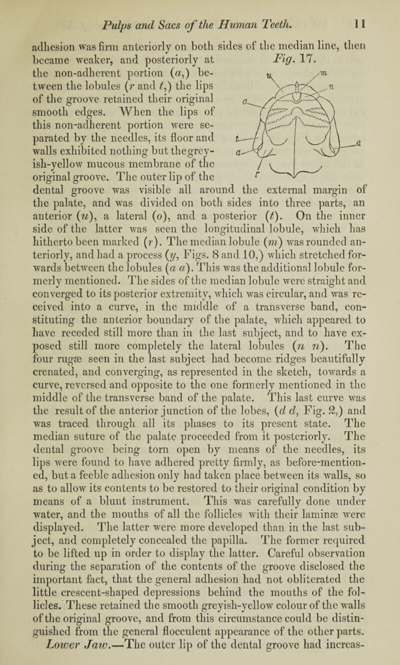 adhesion was firm anteriorly on both sides of the median line, then became weaker, and posteriorly at Fig. 17. the non-adherent portion (a,) be¬ tween the lobules (r and t,) the lips of the groove retained their original smooth edges. When the lips of this non-adherent portion were se¬ parated by the needles, its floor and walls exhibited nothing but thegrey- ish-yellow mucous membrane of the original groove. The outer lip of the dental groove was visible all around the external margin of the palate, and was divided on both sides into three parts, an anterior (w), a lateral (o), and a posterior (t). On the inner side of the latter was seen the longitudinal lobule, which has hitherto been marked (r). The median lobule (m) was rounded an¬ teriorly, and had a process (?/, Figs. 8 and 10,) which stretched for¬ wards between the lobules {a a). This was the additional lobule for¬ merly mentioned. The sides of the median lobule were straight and converged to its posterior extremity, which was circular, and was re¬ ceived into a curve, in the middle of a transverse band, con¬ stituting the anterior boundary of the palate, which appeared to have receded still more than in the last subject, and to have ex¬ posed still more completely the lateral lobules (n n). The four rugae seen in the last subject had become ridges beautifully crenated, and converging, as represented in the sketch, towards a curve, reversed and opposite to the one formerly mentioned in the middle of the transverse band of the palate. This last curve was the result of the anterior junction of the lobes, (d d, Fig. 2,) and was traced through all its phases to its present state. The median suture of the palate proceeded from it posteriorly. The dental groove being torn open by means of the needles, its lips were found to have adhered pretty firmly, as before-mention¬ ed, but a feeble adhesion only had taken place between its walls, so as to allow its contents to be restored to their original condition by means of a blunt instrument. This was carefully done under water, and the mouths of all the follicles with their laminae were displayed. The latter were more developed than in the last sub¬ ject, and completely concealed the papilla. The former required to be lifted up in order to display the latter. Careful observation during the separation of the contents of the groove disclosed the important fact, that the general adhesion had not obliterated the little crescent-shaped depressions behind the mouths of the fol¬ licles. These retained the smooth greyish-yellow colour of the walls of the original groove, and from this circumstance could be distin¬ guished from the general flocculent appearance of the other parts. Lower Jaw.—The outer lip of the dental groove had increas-