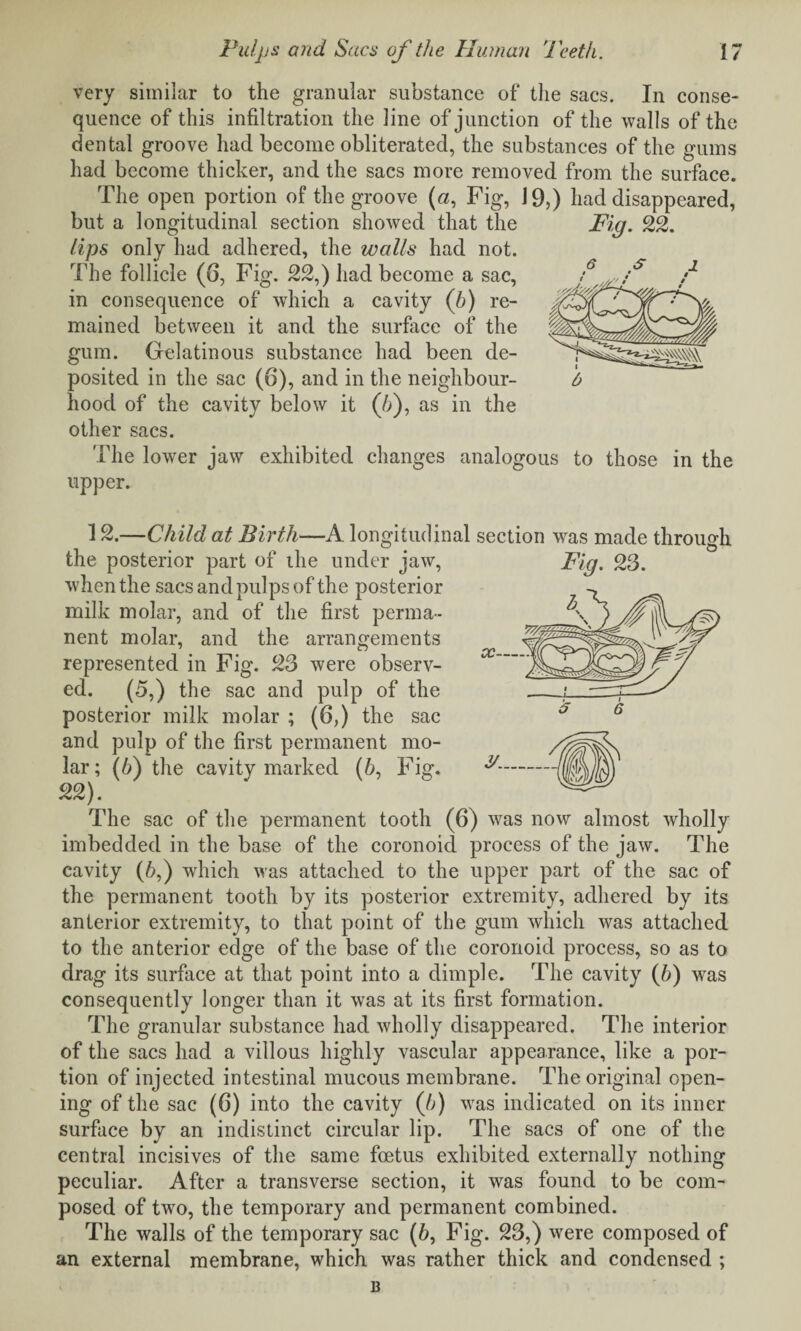 very similar to the granular substance of the sacs. In conse¬ quence of this infiltration the line of junction of the walls of the dental groove had become obliterated, the substances of the gums had become thicker, and the sacs more removed from the surface. The open portion of the groove (a, Fig, 19,) had disappeared, but a longitudinal section showed that the Fig. 22. lips only had adhered, the walls had not. The follicle (6, Fig. 22,) had become a sac, in consequence of which a cavity (b) re¬ mained between it and the surface of the gum. Gelatinous substance had been de¬ posited in the sac (6), and in the neighbour¬ hood of the cavity below it (/;), as in the other sacs. The lower jaw exhibited changes analogous to those in the upper. 12.—Child at Birth—A longitudinal section was made through the posterior part of ihe under jaw, Fig, 23. when the sacs and pulps of the posterior milk molar, and of the first perma¬ nent molar, and the arrangements represented in Fig. 23 were observ¬ ed. (5,) the sac and pulp of the posterior milk molar ; (6,) the sac and pulp of the first permanent mo¬ lar; (b) the cavity marked (6, Fig. 22). The sac of the permanent tooth (6) was now almost wholly imbedded in the base of the coronoid process of the jaw. The cavity (6,) which was attached to the upper part of the sac of the permanent tooth by its posterior extremity, adhered by its anterior extremity, to that point of the gum which was attached to the anterior edge of the base of the coronoid process, so as to drag its surface at that point into a dimple. The cavity (6) was consequently longer than it was at its first formation. The granular substance had wholly disappeared. The interior of the sacs had a villous highly vascular appearance, like a por¬ tion of injected intestinal mucous membrane. The original open¬ ing of the sac (6) into the cavity (h) was indicated on its inner surface by an indistinct circular lip. The sacs of one of the central incisives of the same foetus exhibited externally nothing peculiar. After a transverse section, it was found to be com¬ posed of two, the temporary and permanent combined. The walls of the temporary sac (6, Fig. 23,) were composed of an external membrane, which was rather thick and condensed ; 13