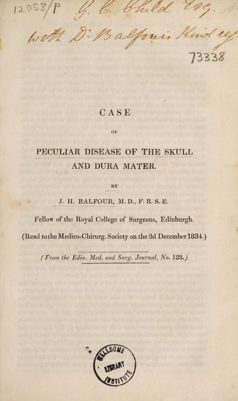 CASE OP PECULIAR DISEASE OF THE SKULL AND DURA MATER. BY J. H. BALFOUR, M. D., F. R. S. E. Fellow of the Royal College of Surgeons, Edinburgh. (Read totheMedico-Chirurg. Society on the 3d December 1834.) (From the Edin. Med. and Surg. Journal, No. 123.^