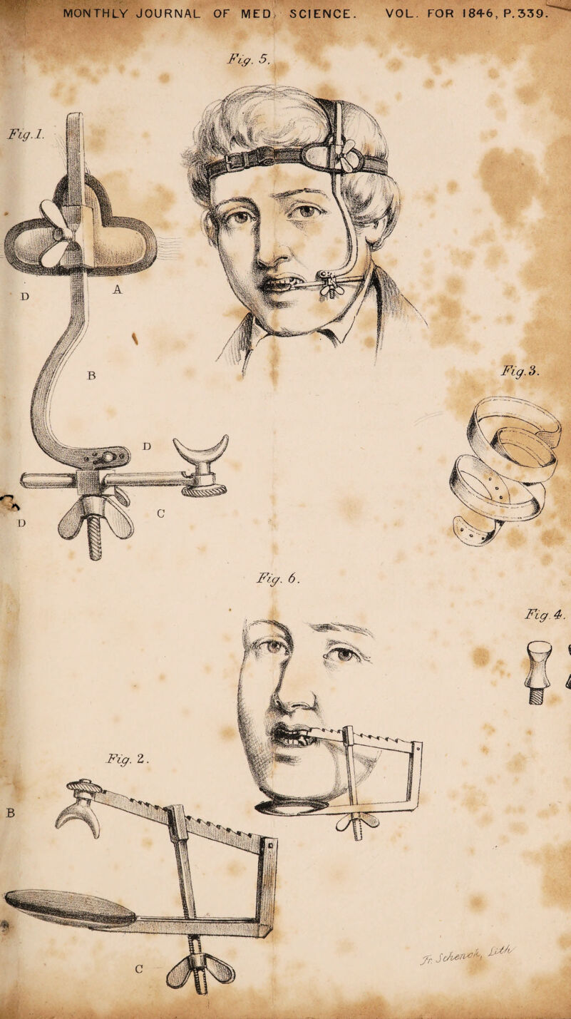 MONTHLY JOURNAL OF MED SCIENCE VOL. FOR I 84-6, P.339 Fig. 5. Fig. 6. Fig. 3.